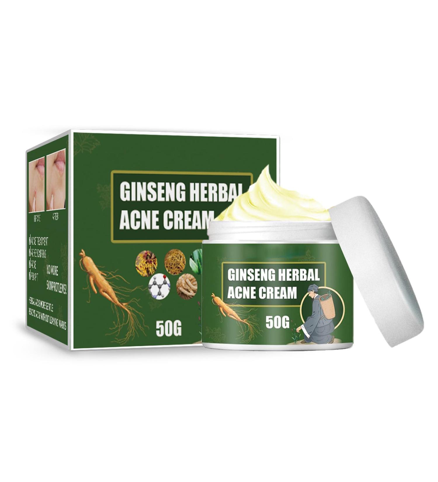 Acne Treatment Cream with 5% Benzoyl Peroxide & Tea Tree Oil - Cystic Acne Spot Treatment for Face - 1.67 oz - Buy Online on GoSupps.com