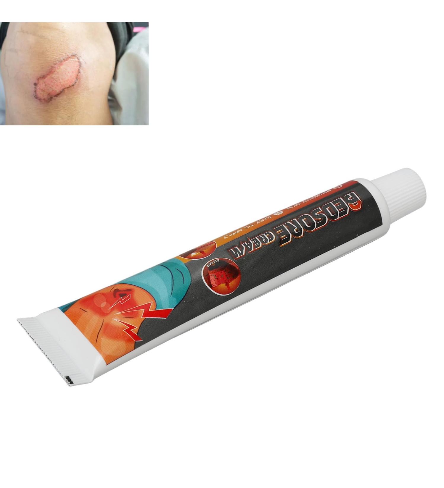 Decubitus Wound Cream 20 G 2 Pieces Fast-Acting Decubitus Wound Treatment Cream Remove Rot Myogenic Infection Protection Ointment for Bed Sores Wound Healing Body Care - Buy Online on GoSupps.com