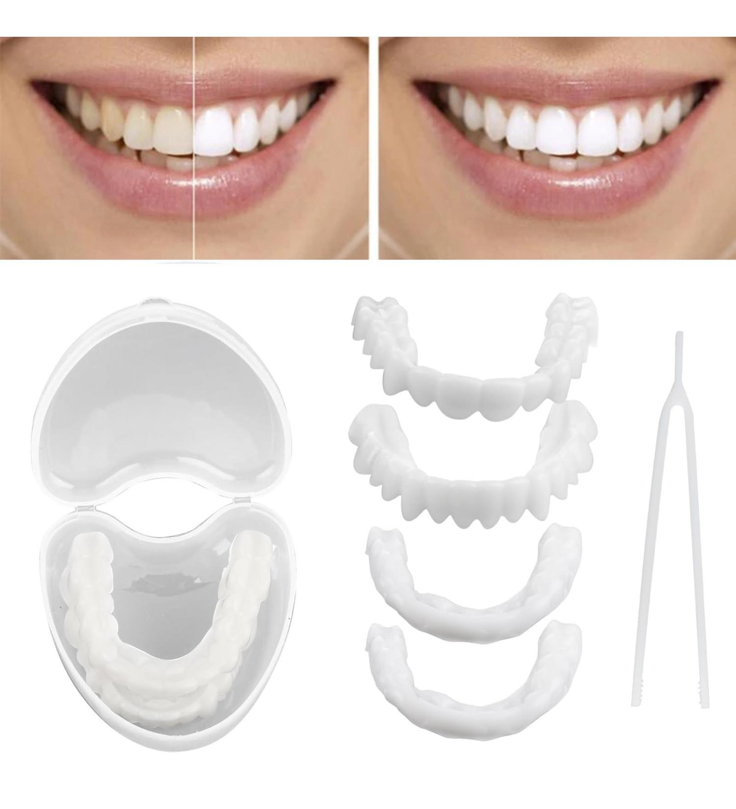 Brigtviee Cosmetic Veneers Teeth - 2 Pairs of Temporary False Teeth for Men & Women - Instant Dentures & Prosthetics for a Perfect Smile - Buy Online on GoSupps.com