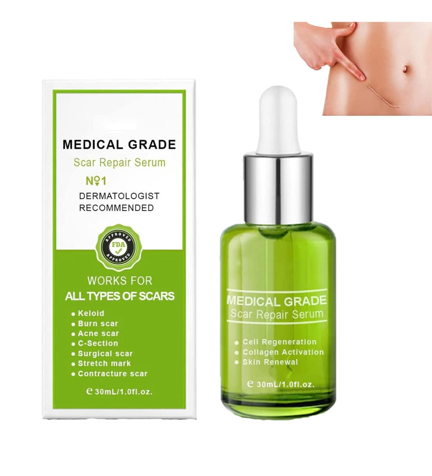 Proregen Medical Grade Scar Removal Spray - Advanced Formula for All Types of Scars (1pcs) - Buy Online on GoSupps.com