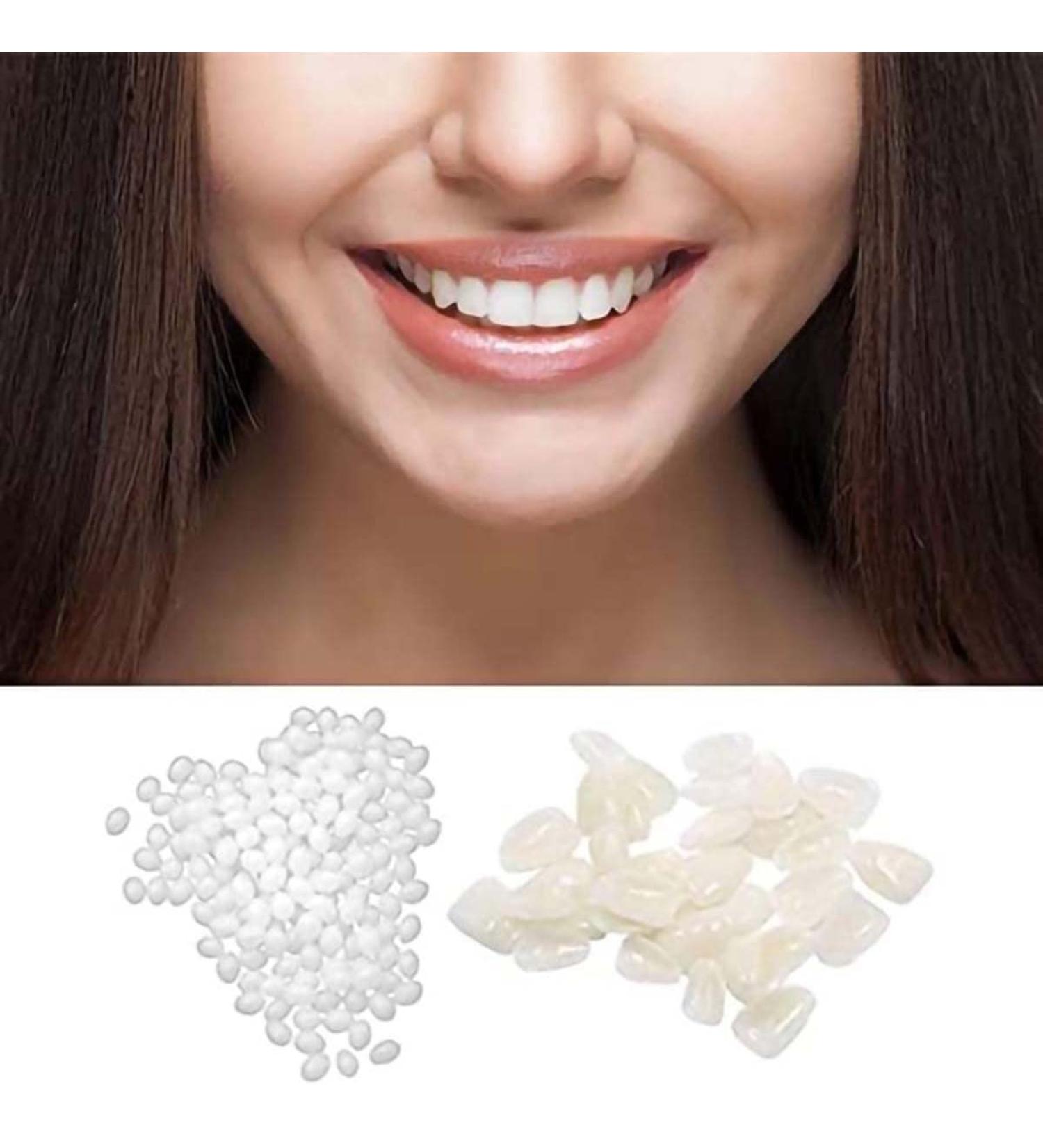 OTCPP Temporary Tooth Repair Kit - 50g Filling Beads & 60pcs Thermal Beads Replacement - Buy Online on GoSupps.com