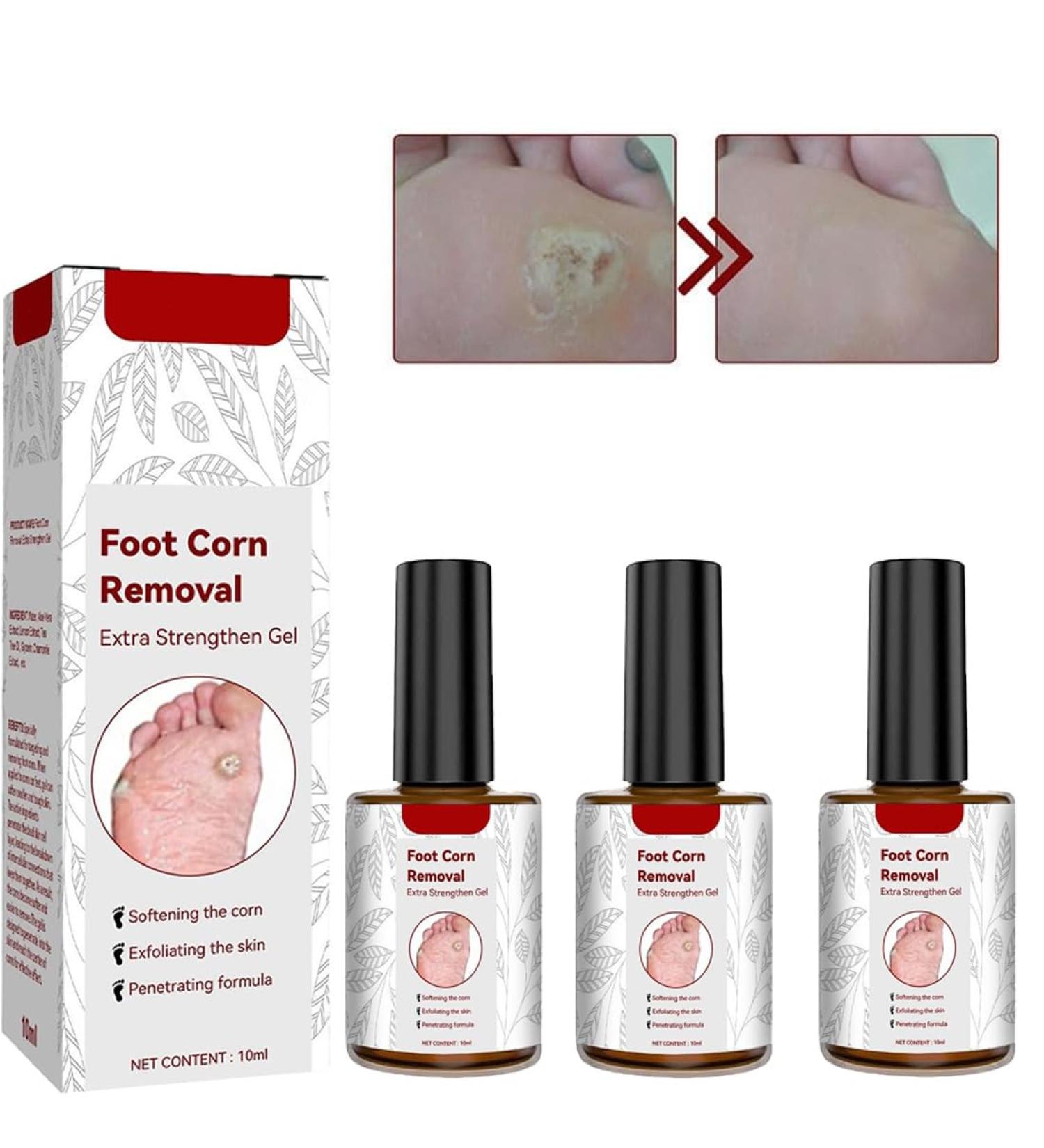 VERAMY Foot Corn Removal Extra Strength Gel - Quick Corn Remover Liquid (3PCS) - Buy Online on GoSupps.com