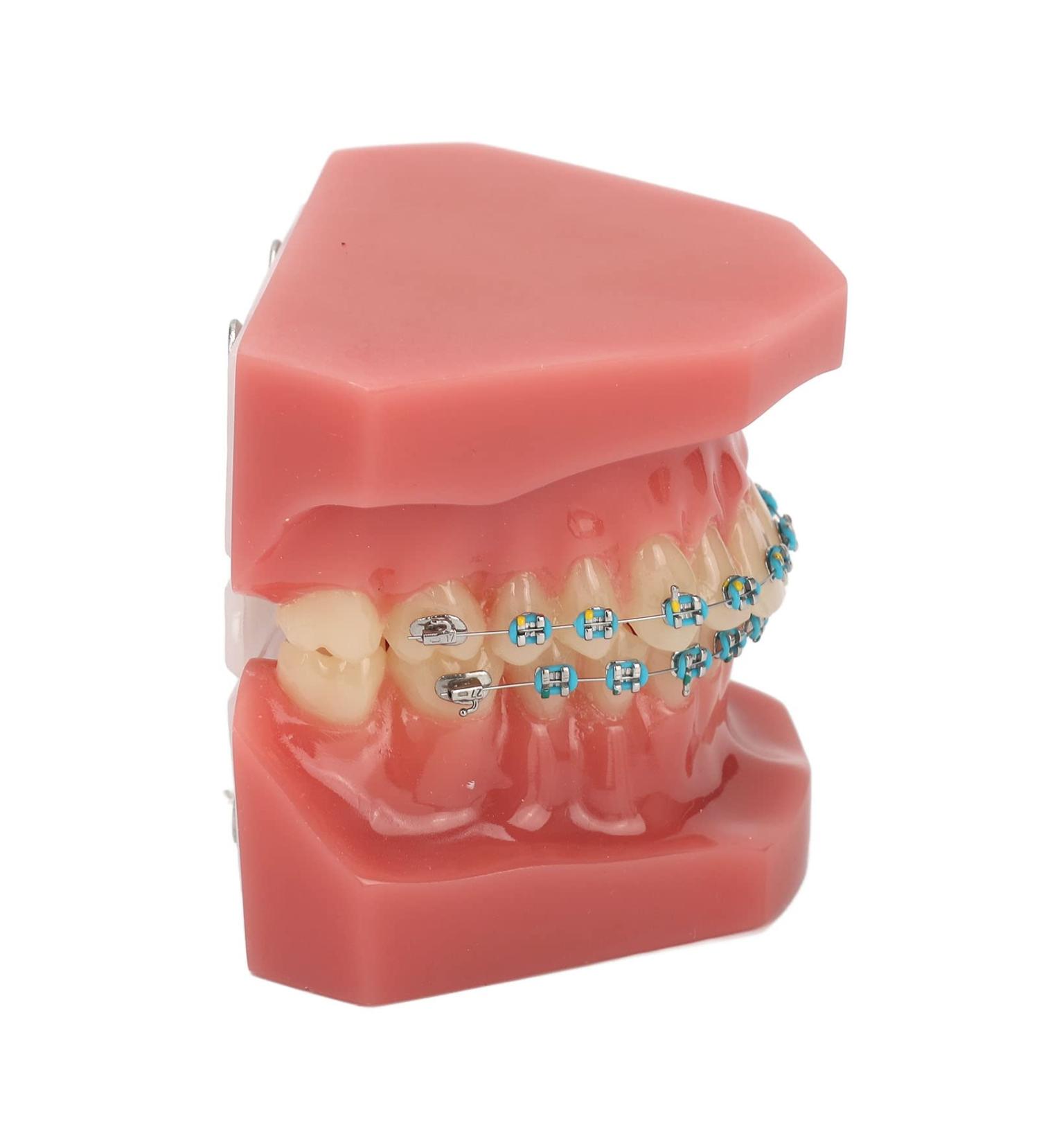 Typodont Orthodontic Tooth Model (28 Teeth) - Realistic Crowded Teeth & Malocclusion Representation for Dental Education & Practice - Buy Online on GoSupps.com
