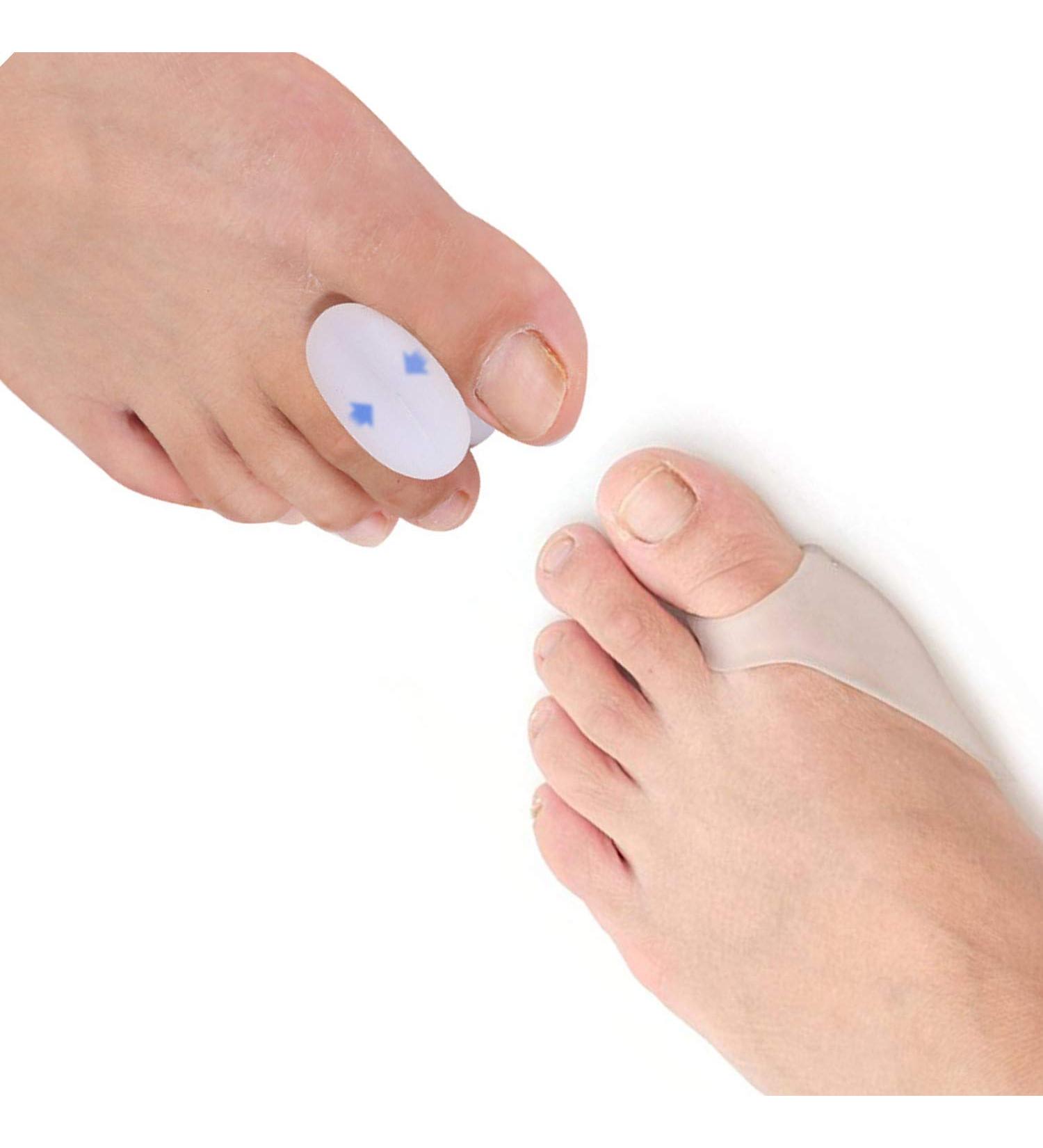 PEDIMEND Silicone Gel Toe Separator + Silicone Gel Big Toe Bunion Guard (2PAIR - 4PCS) | Prevent Painful Rubbing | Gel Protector Sleeve for Corns Callus Blisters Ingrown Toe Nail | Foot Care - Buy Online on GoSupps.com