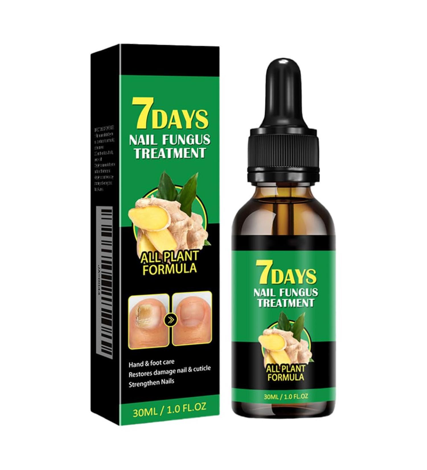  Cymwer Ginger Nail Serum 30ml Natural Growth Oil Strengthener for Fortified Nails Moisturizing and Revitalizing Care - Buy Online on GoSupps.com