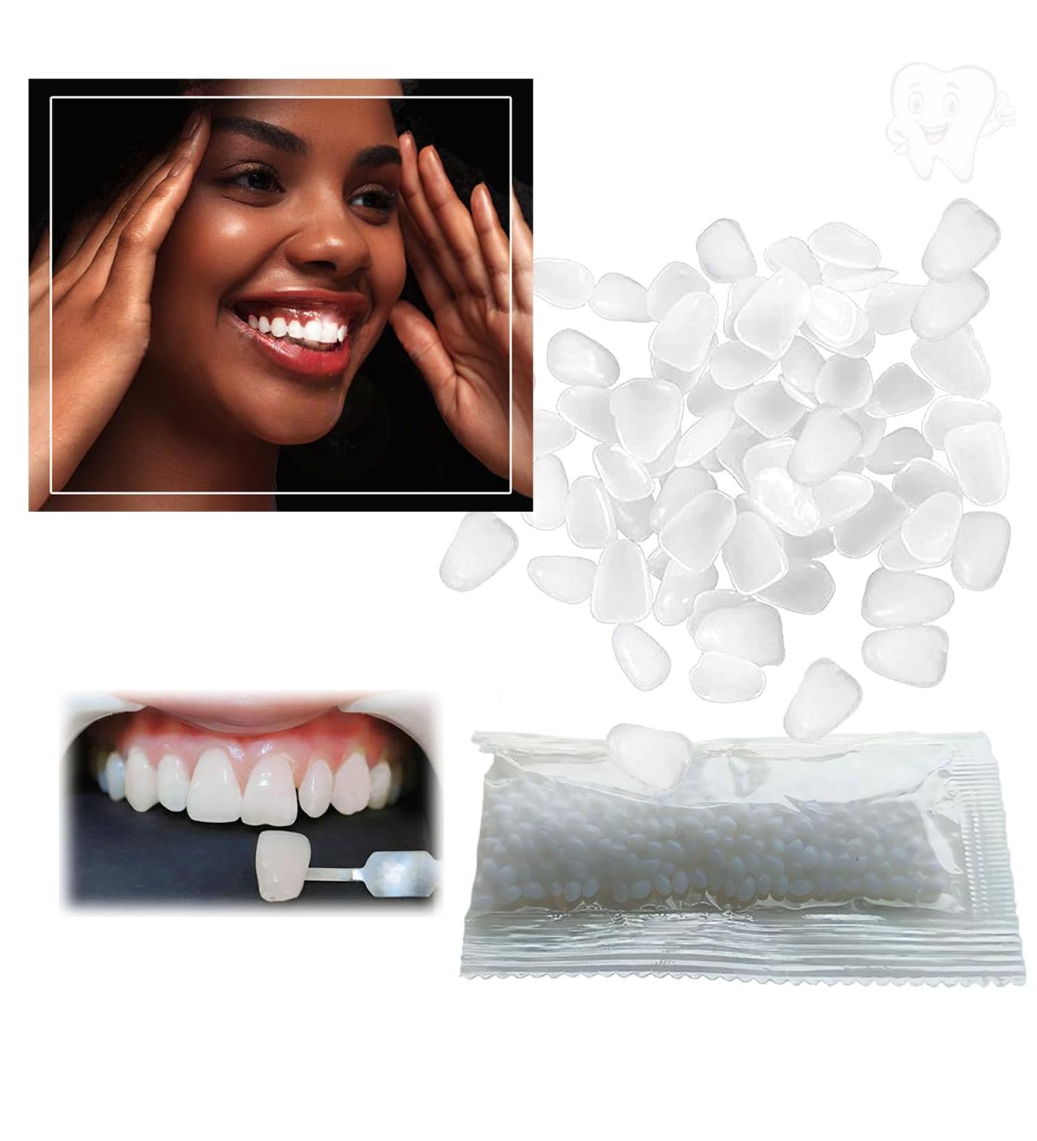 Temporary Tooth Repair Kit - Moldable Fake Teeth & Thermal Fitting Beads for Quick Tooth Replacement | White Teeth Repair Solution - Buy Online on GoSupps.com