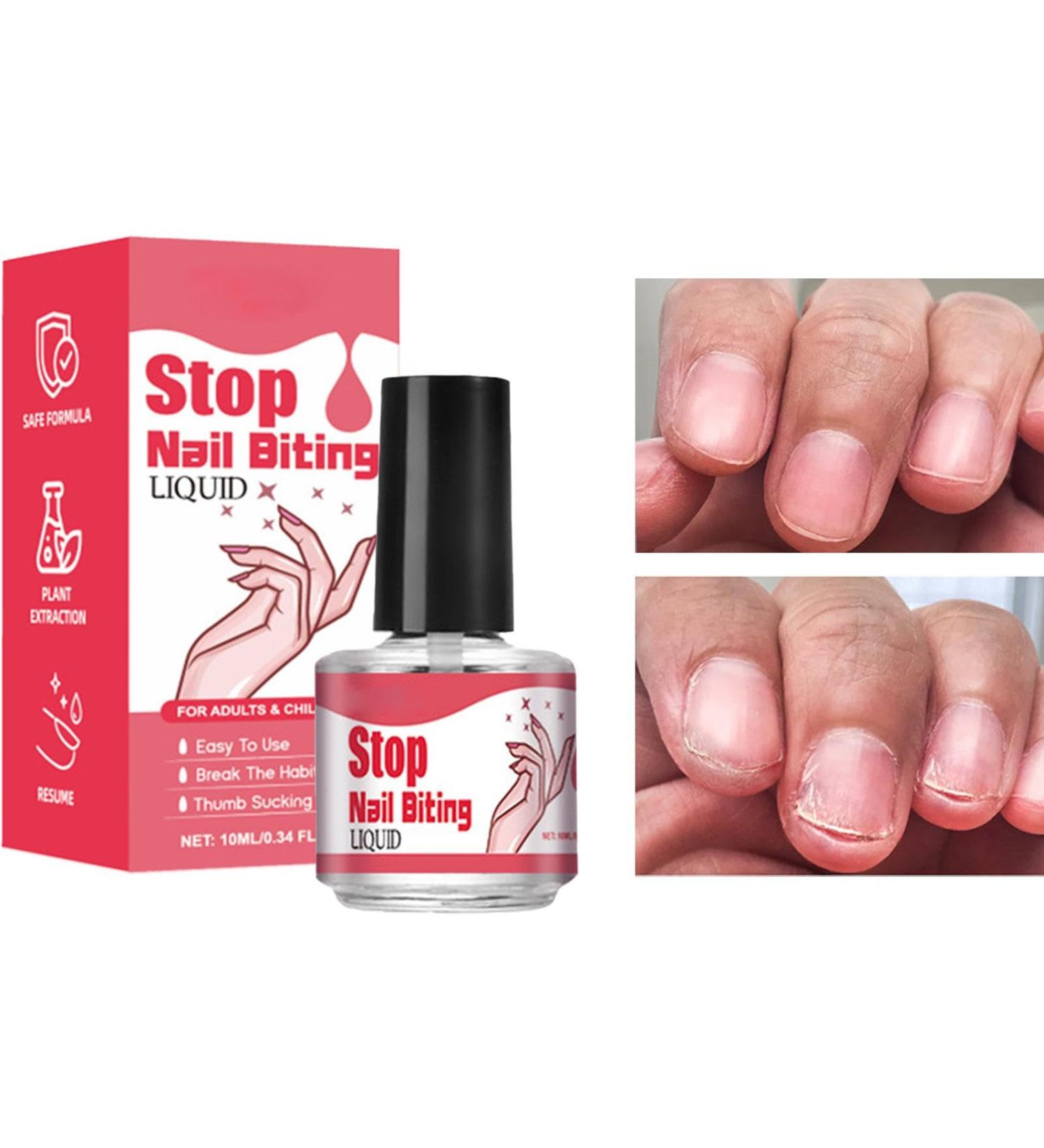 Nail Biting Polish For Kids Thumb Sucking Product 10ML Stop Nail Biting Thumb Sucking Stop Biting Nails Kids Dual-Effect Long-Lasting For Stop Thumb Sucking - Buy Online on GoSupps.com