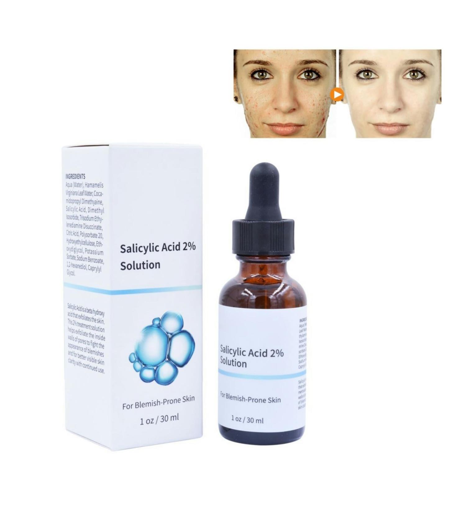 Salicylic Acid Concentrate Super Strong 2% - Acne Spot Treatment - Professional Skincare Serum White 1 - Buy Online on GoSupps.com
