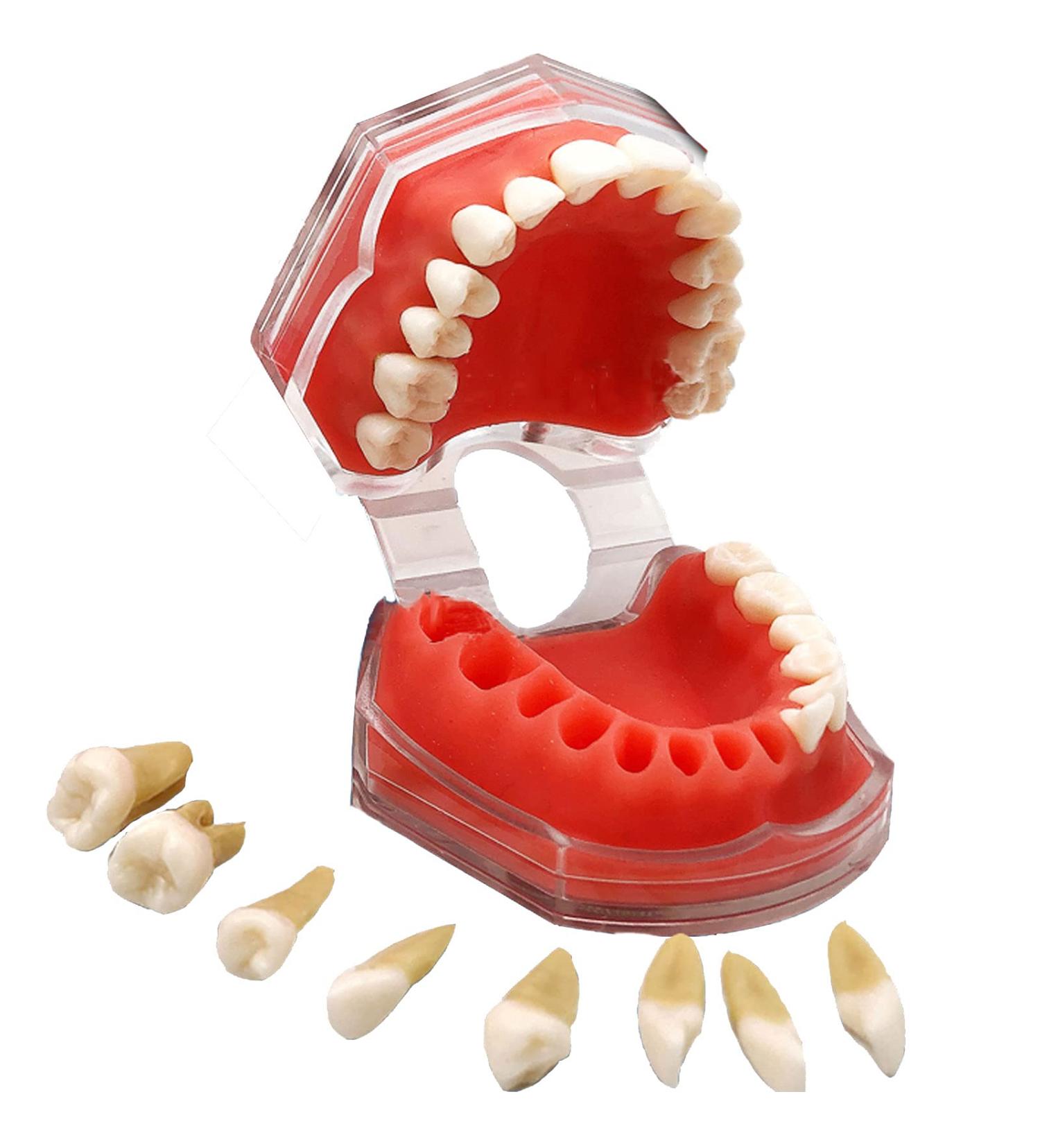 Bovdc Full Mouth Removable Dentistry Model - Soft Gums Tooth Model for Dental Students & Assistants | Ideal for Extraction Learning | International Shipping Available - Buy Online on GoSupps.com