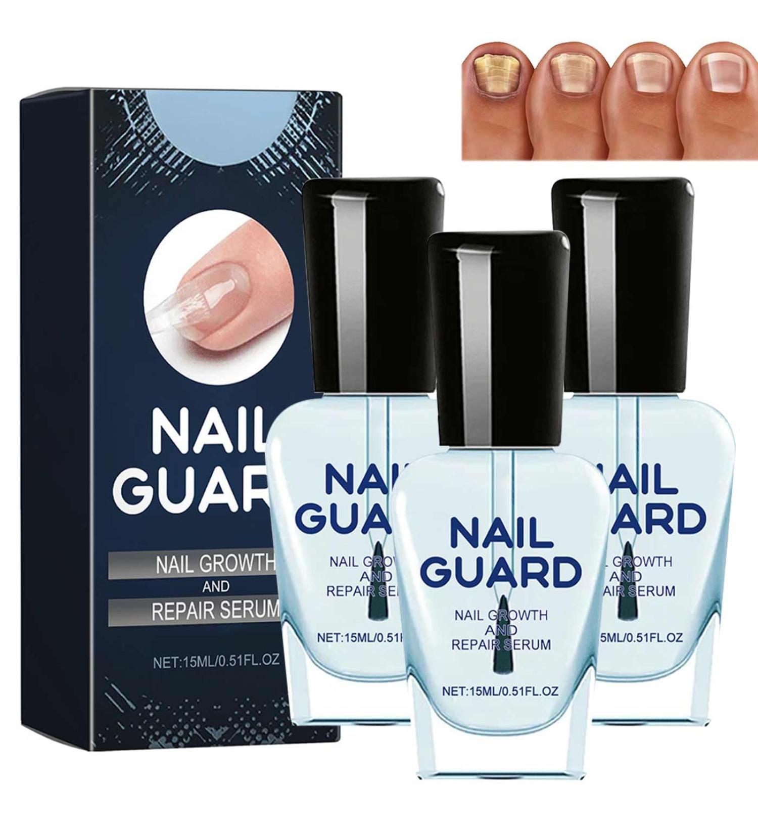 SHENGZE Onyxoguard Nail Growth and Repair Serum3pcs Nail Growth and Repair SerumNail Growth and Strengthening OilNail Repair for Damaged NailsNail StrengthenerNail Growth Serum for Thin Nails and Growth - Buy Online on GoSupps.com