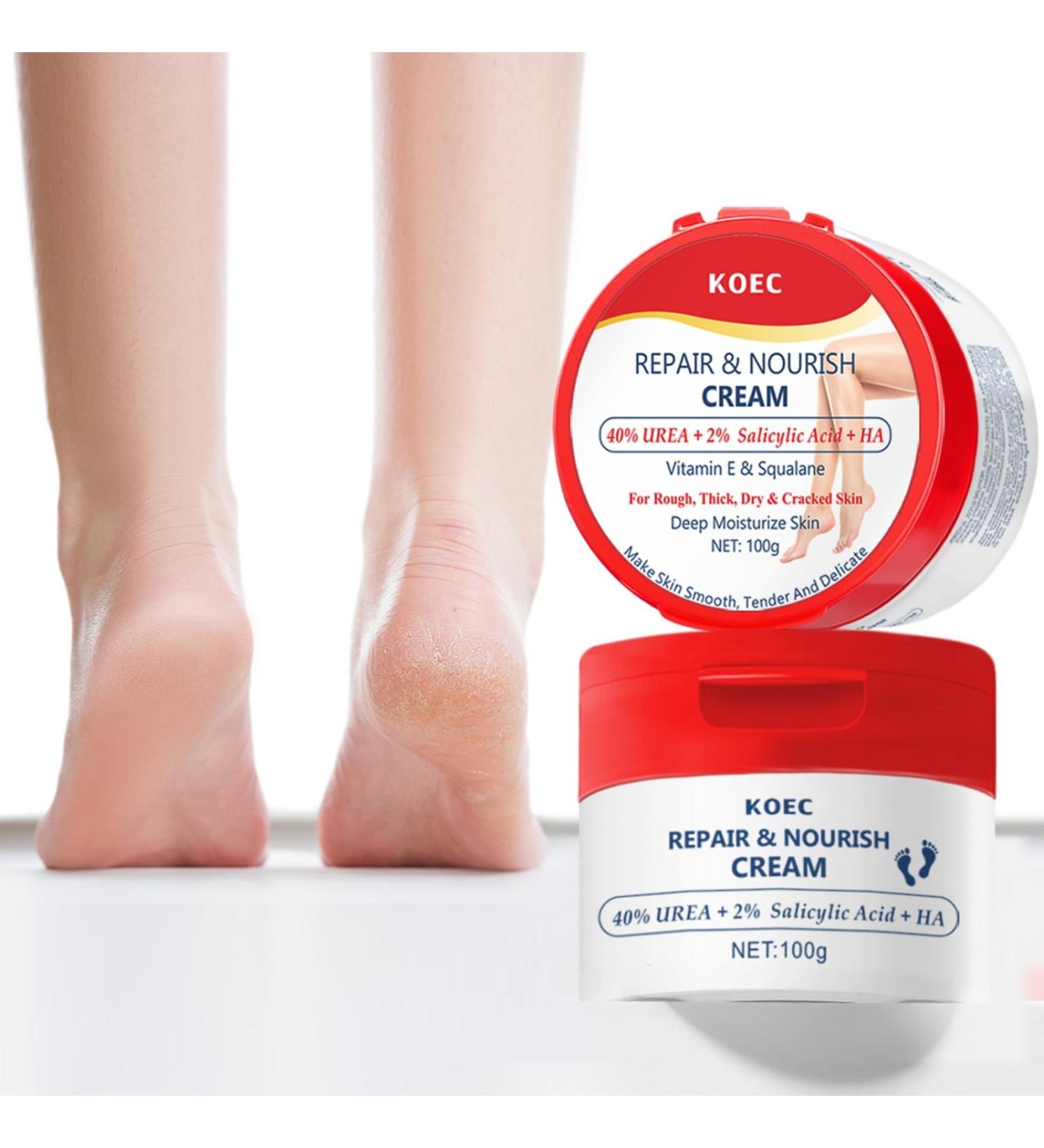 Urea Cream for Cracked Dry Feet & Heels Softening Repair Exfoliating Moisturizing Cream for Dry Cracked Feet and Feet Calluses Chicken Skin and Elbow - 100g - Buy Online on GoSupps.com