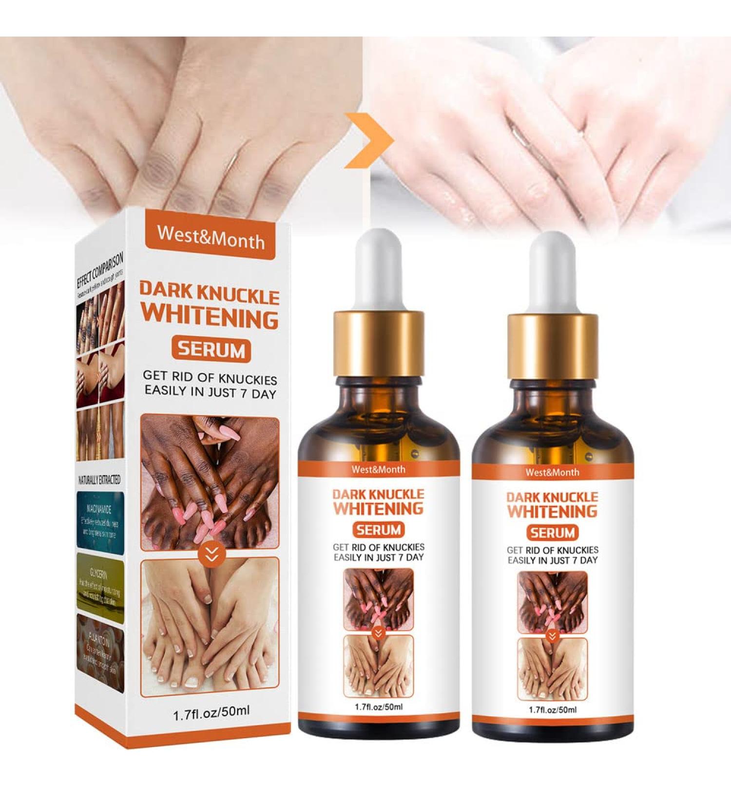 Whitening Serum Hand Knuckle Glow Serum - 2PCS, 1.7 Fl Oz - Restoring Treatment for Dark Knuckle Elbow - Moisturizing & Exfoliating Formula for Brighter, Firmer Skin - Buy Online on GoSupps.com