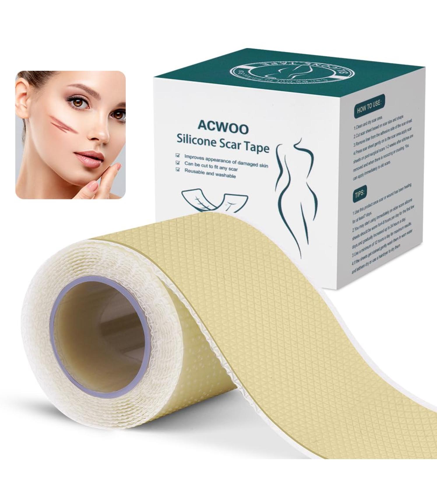 ACWOO Silicone Scar Sheets (1.6 x 40 1M) - Professional Reusable Soft Tape for Scar Removal - C-Section, Surgery, Burn, Keloid, Acne - Painless New and Old Scar Treatment - Buy Online on GoSupps.com