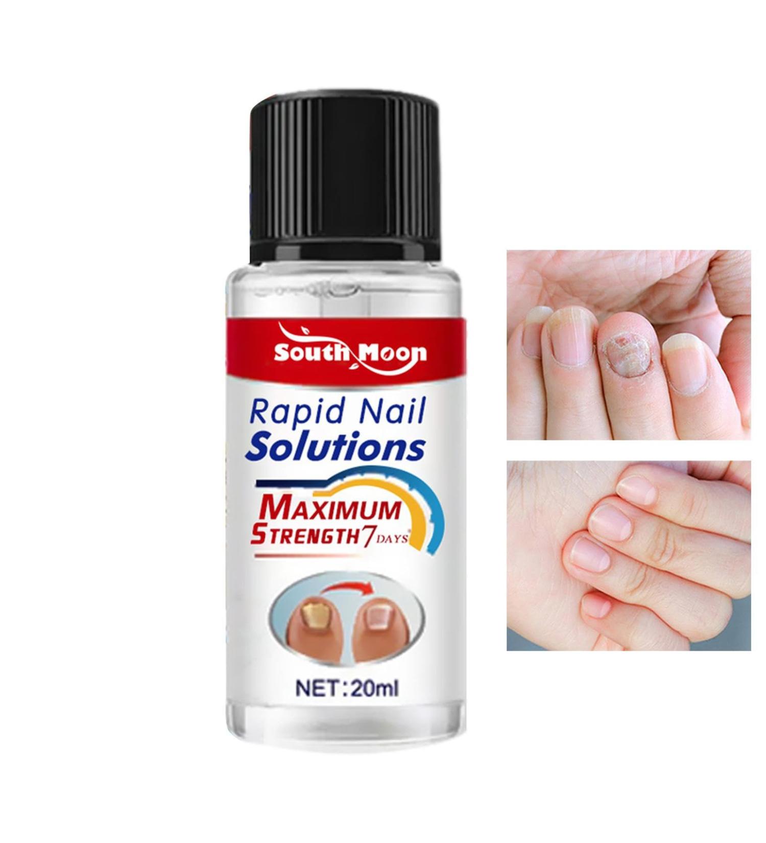 Cuticle and Nail Oil Nail Repair for Growth - Gentle Nail Cuticle Conditioner Nail Hardener and Growth Polish for Odavom - Buy Online on GoSupps.com