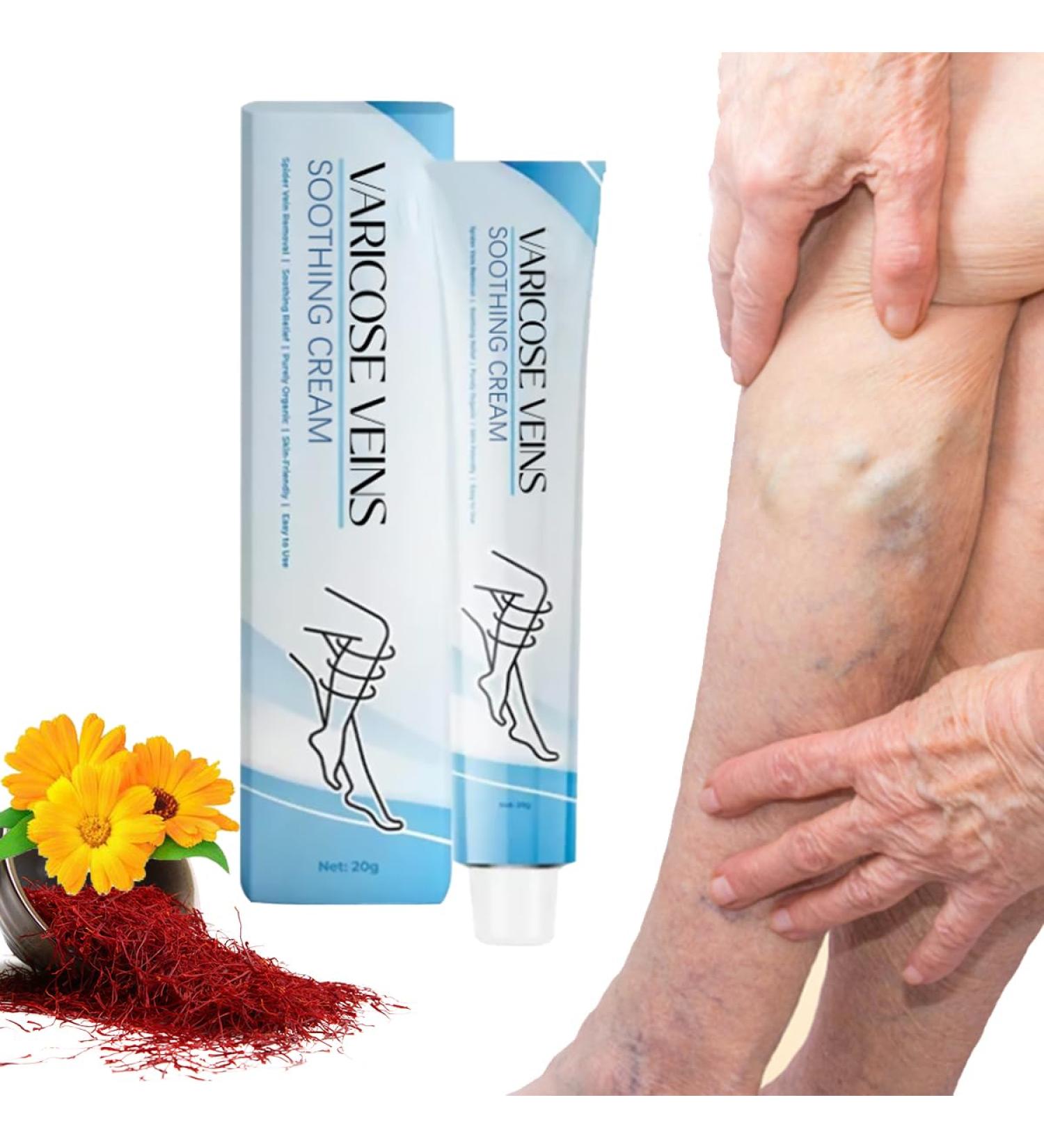 Raura Varicose Veins Treatment Cream Raura Varicose Veins Cream Varicose Veins Treatment for Legs (1) - Buy Online on GoSupps.com