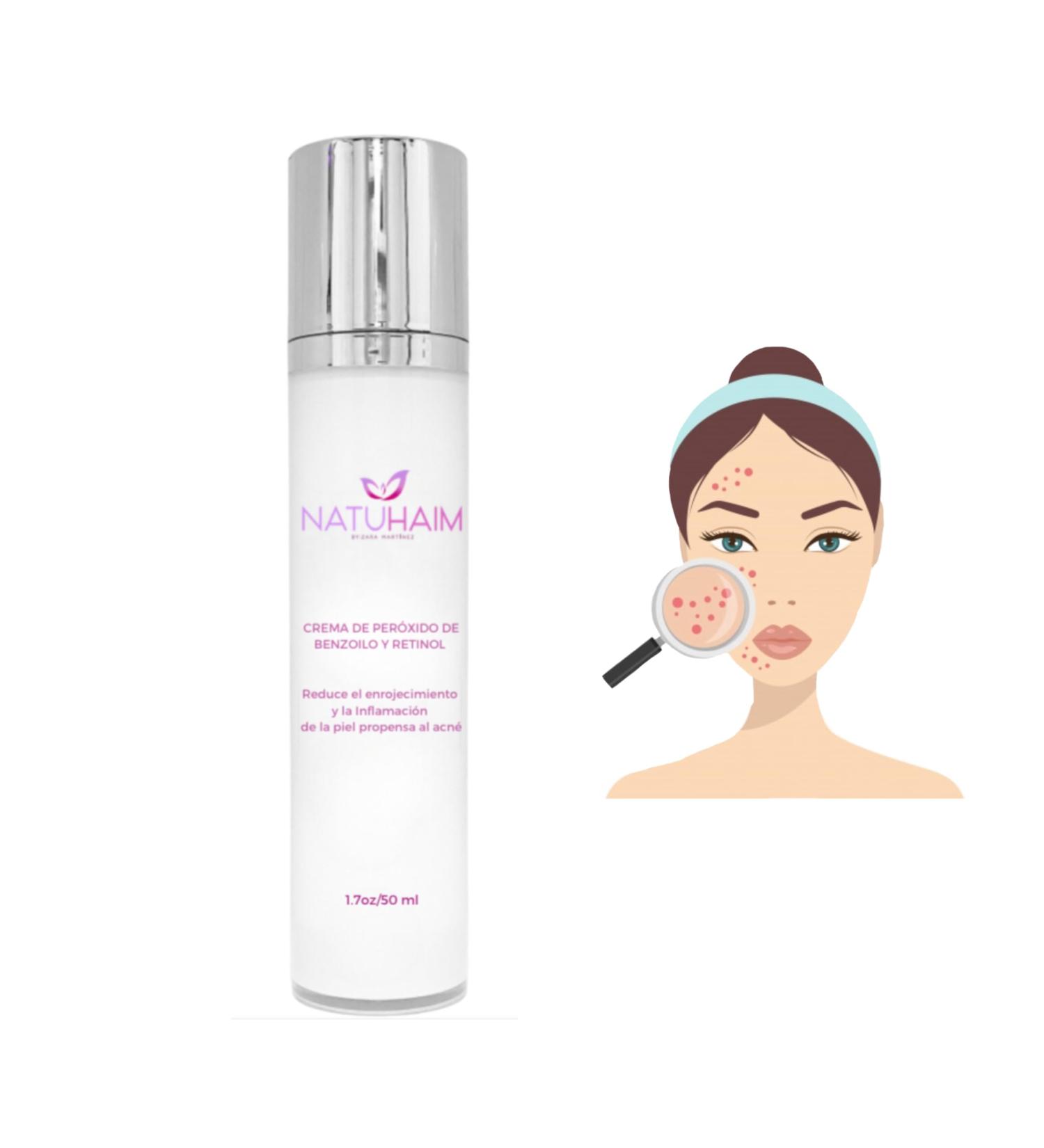 Elimina el acn con el peroxido de benzoilo y retinol Natuhaim - Benzoyl Peroxide and Retinol Cream for Acne-Prone Skin 1.7oz Anti-Aging Treatment