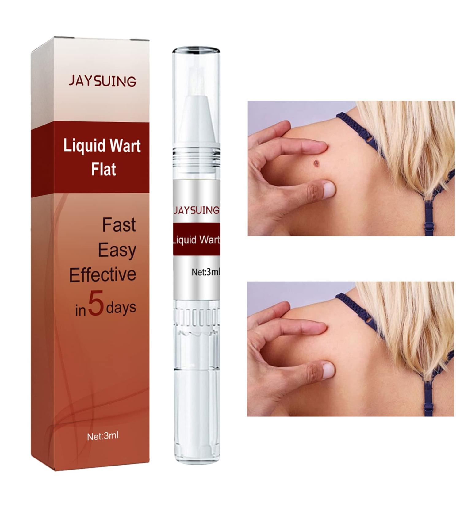 Wipe Off Tags & Moles Remover Fast Easy Effective Quick & Safe Remove Skin Tags Moles Remover Pen 1/2/3/5 PCS - Buy Online on GoSupps.com