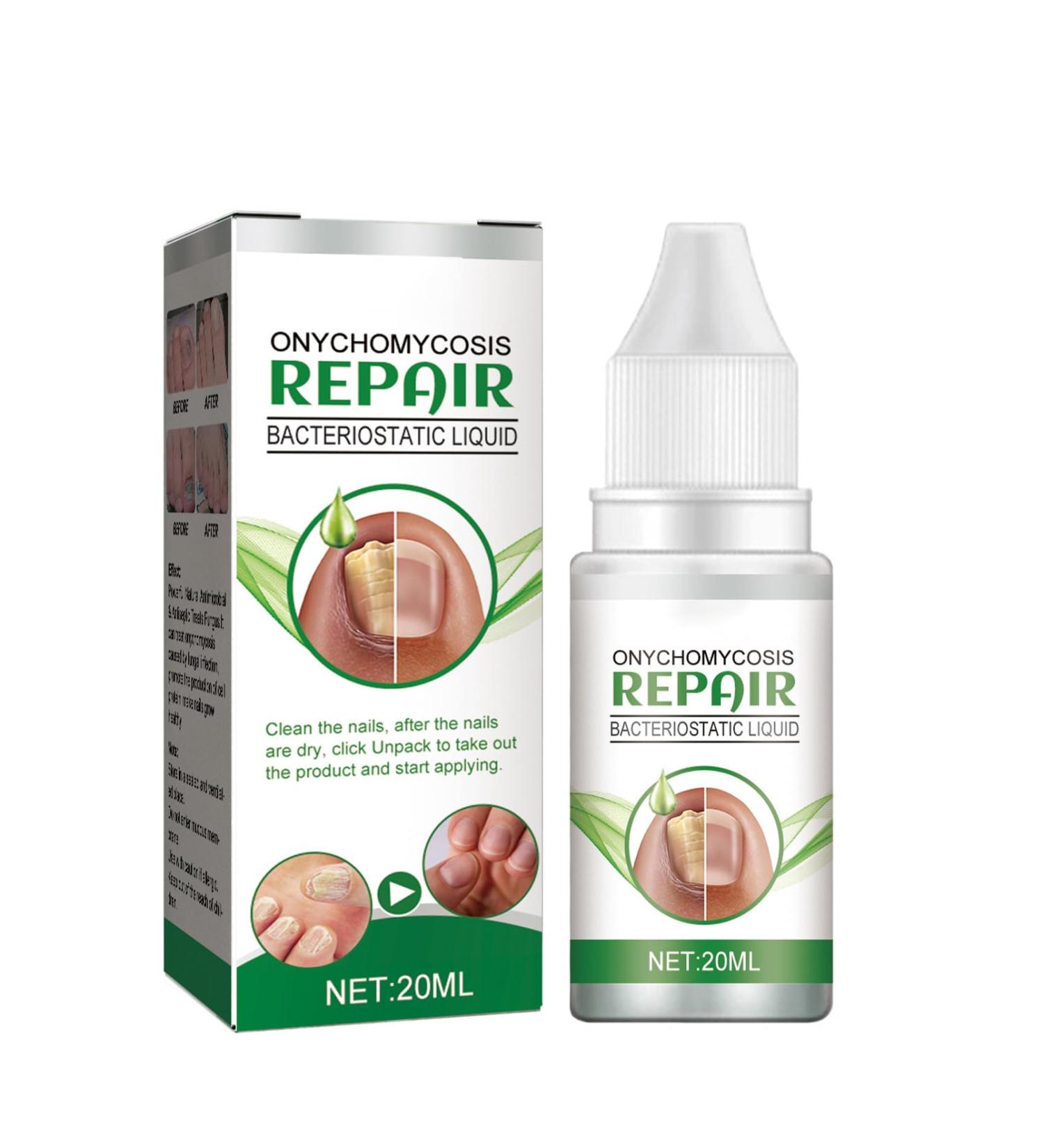 Fungal Nail Serum for Toenails Extra Strong Natural Anti Fungal Nail Serum Severe Fungal Nail Serum for Toenails and Fingernails Anti fungus Nail Improve and Strengthen - Buy Online on GoSupps.com