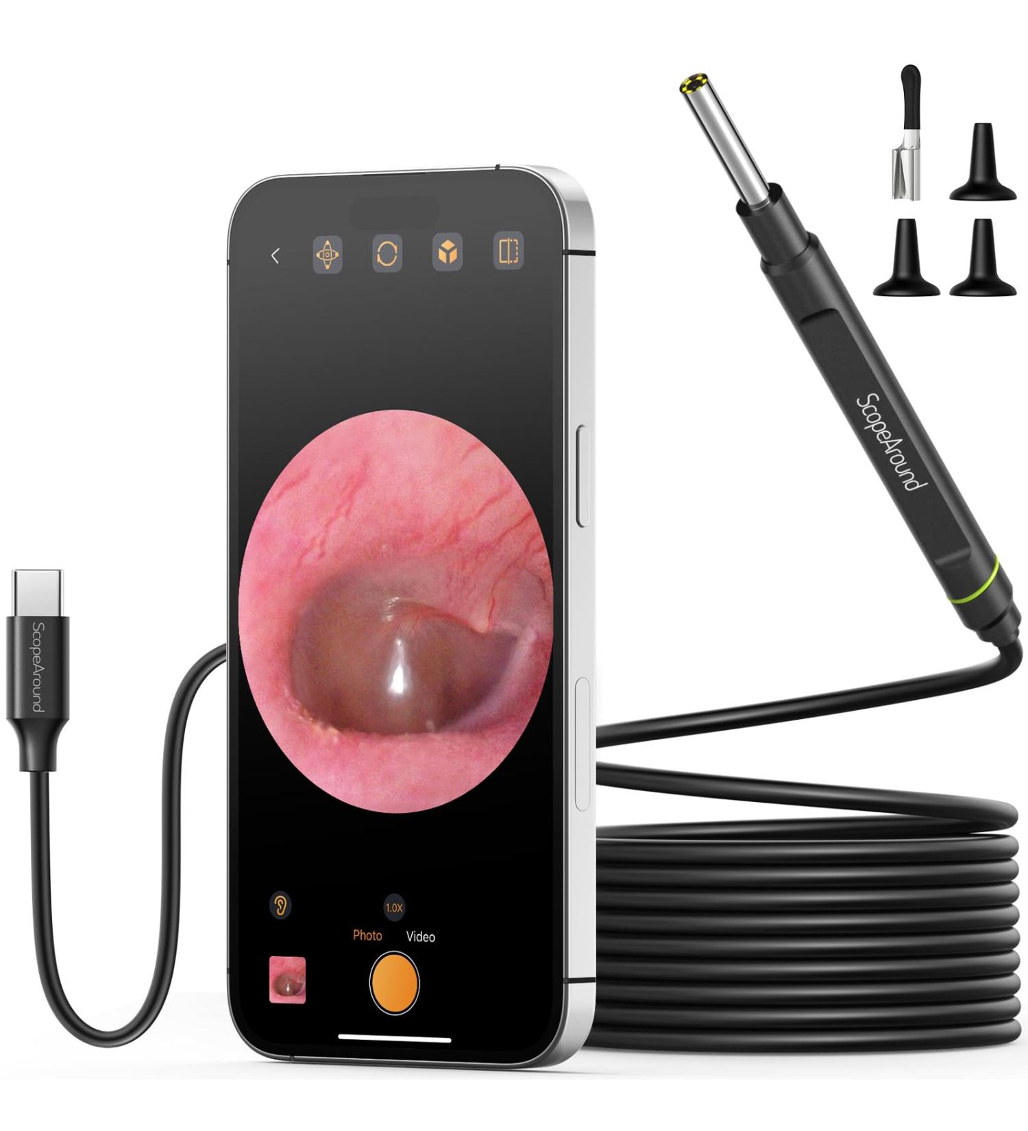 ScopeAround Otoscope Ear Camera Ear Wax Removal Tool 1080P Otoscope