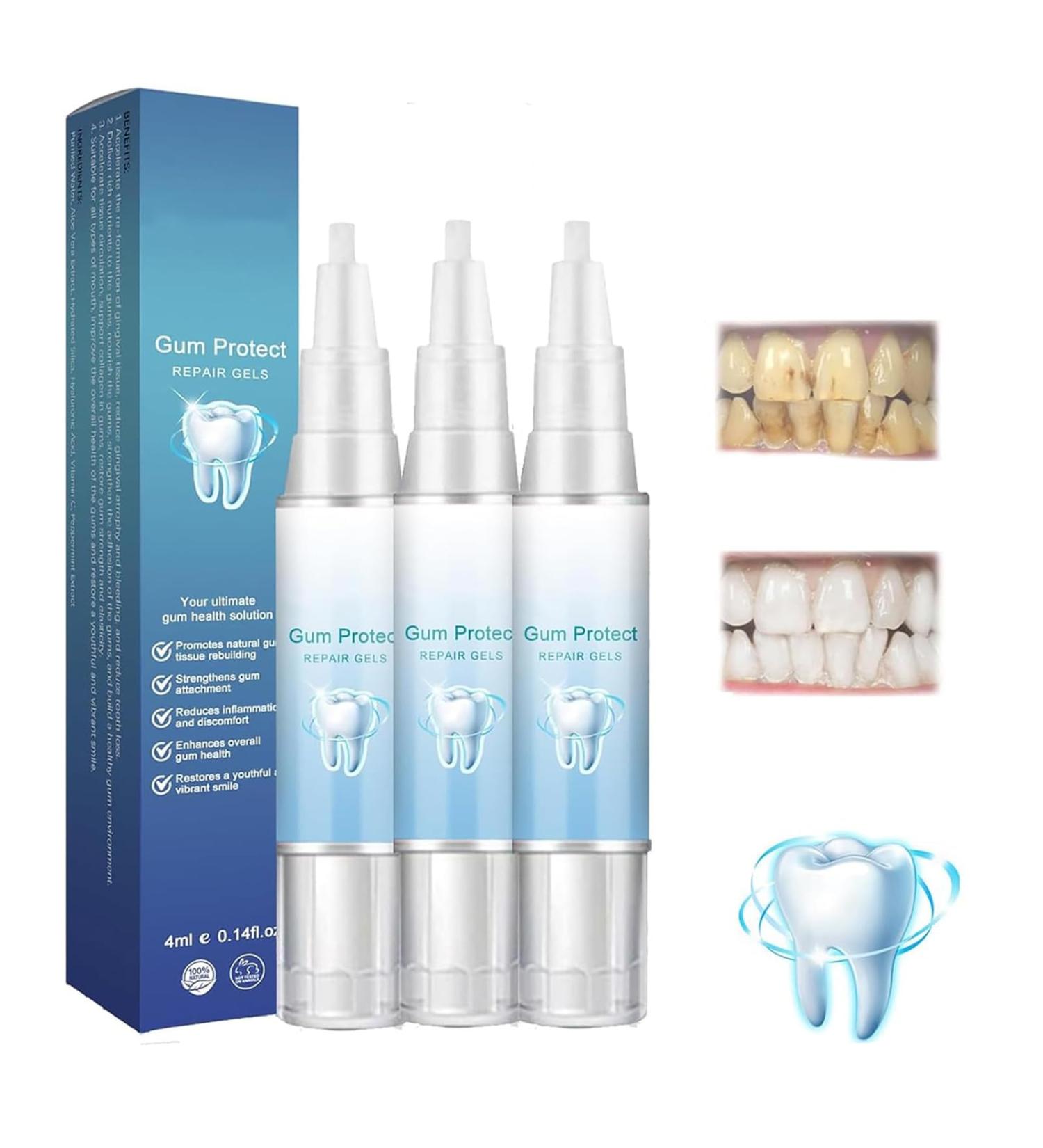 Gums Therapy Gel - Repair Swollen Gums Reduce Pain & Deep Clean Teeth Stains - 3 Piece Set - Buy Online on GoSupps.com