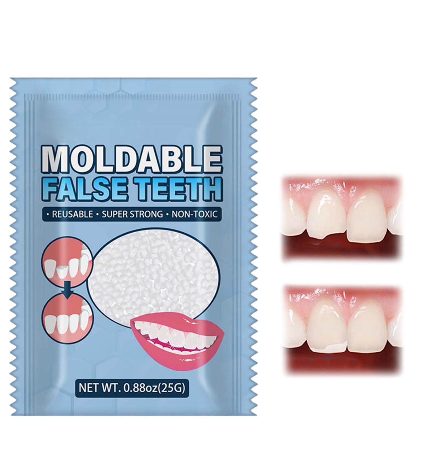 Kit de Dent Provisoire R paration 2025 New Dent Provisoire Proth ses Dentaires Instantan es R paration Temporaire des Dents pour Fixer la Dent Cass e Manquante Remplissante 25g - Buy Online on GoSupps.com