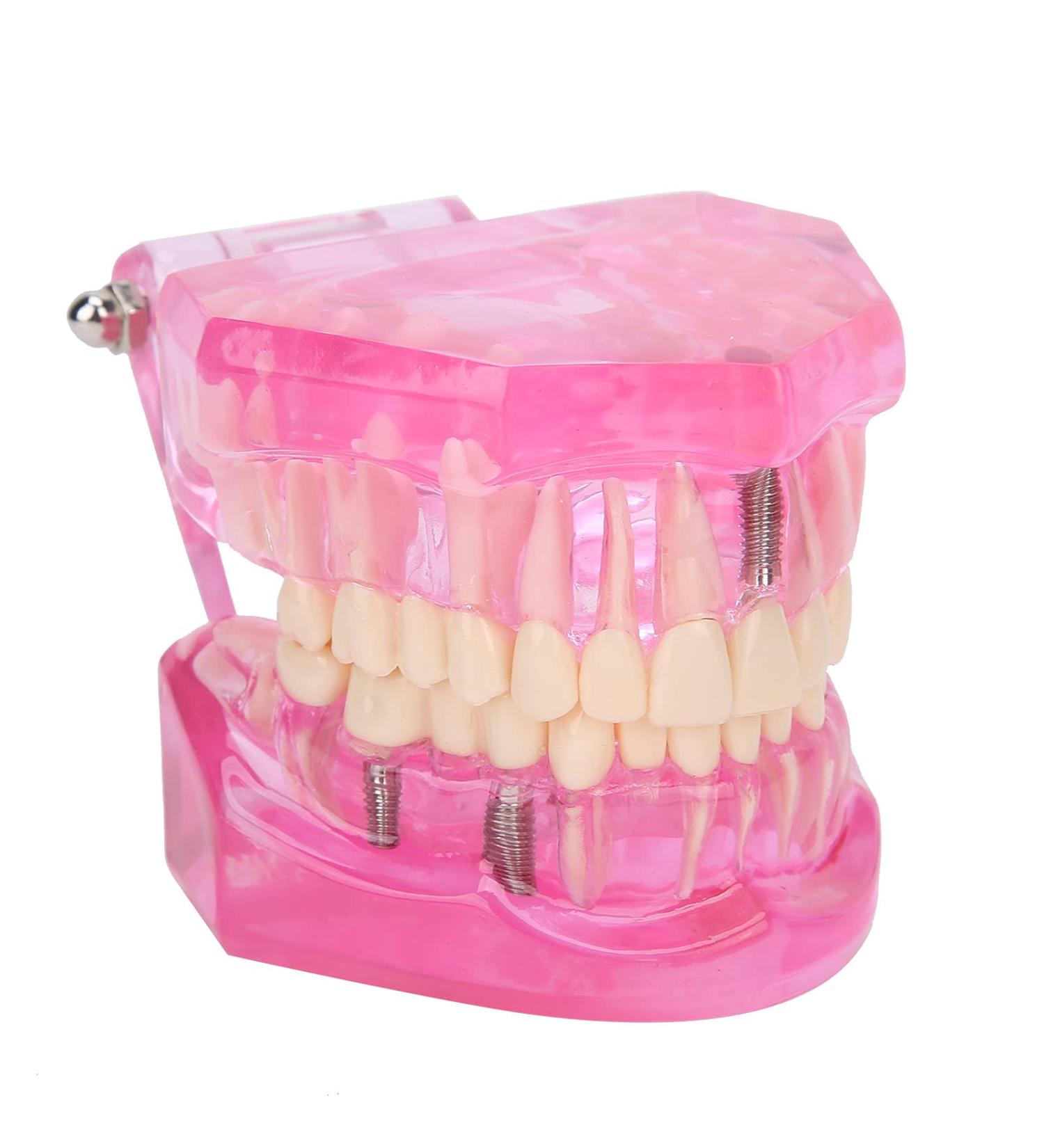 Dentalmodell f r Erwachsene - Klar Zahnmodell f r Studium & Unterricht | Internationaler Versand - Buy Online on GoSupps.com