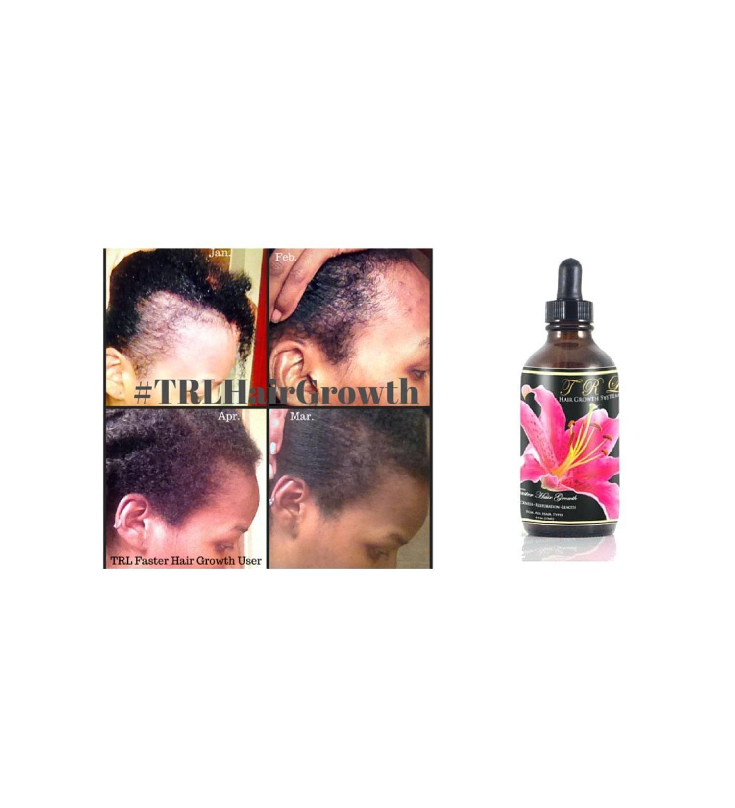 TRL Faster Hair Growth Solution - Black Castor Oil Coconut Oil olive Oil Neem Amla Fenugreek Tea Tree Rosemary (1Pack)