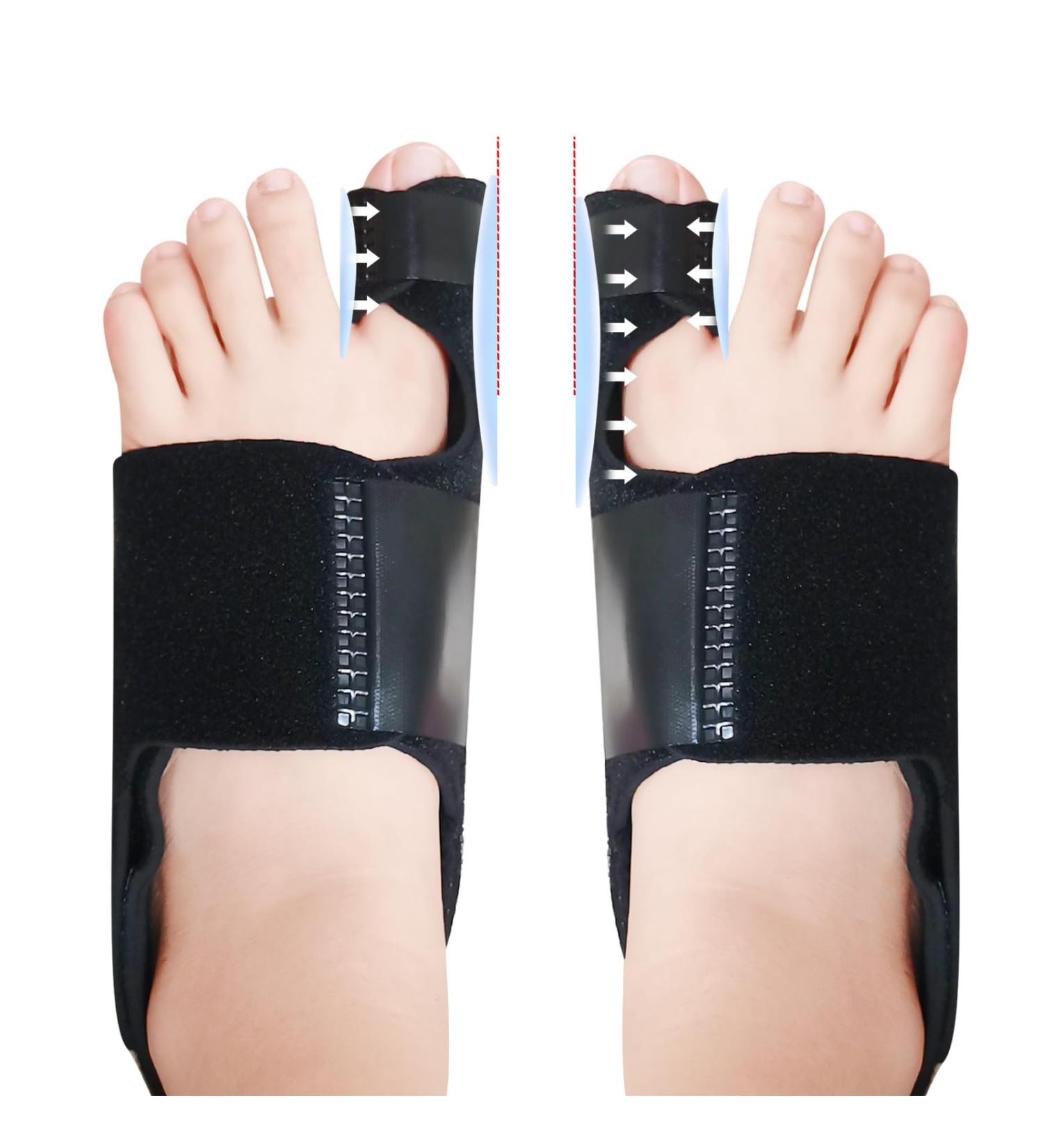 Buy Bunion Splints 03 Effective Relief & International Shipping | Your Store Name - Buy Online on GoSupps.com