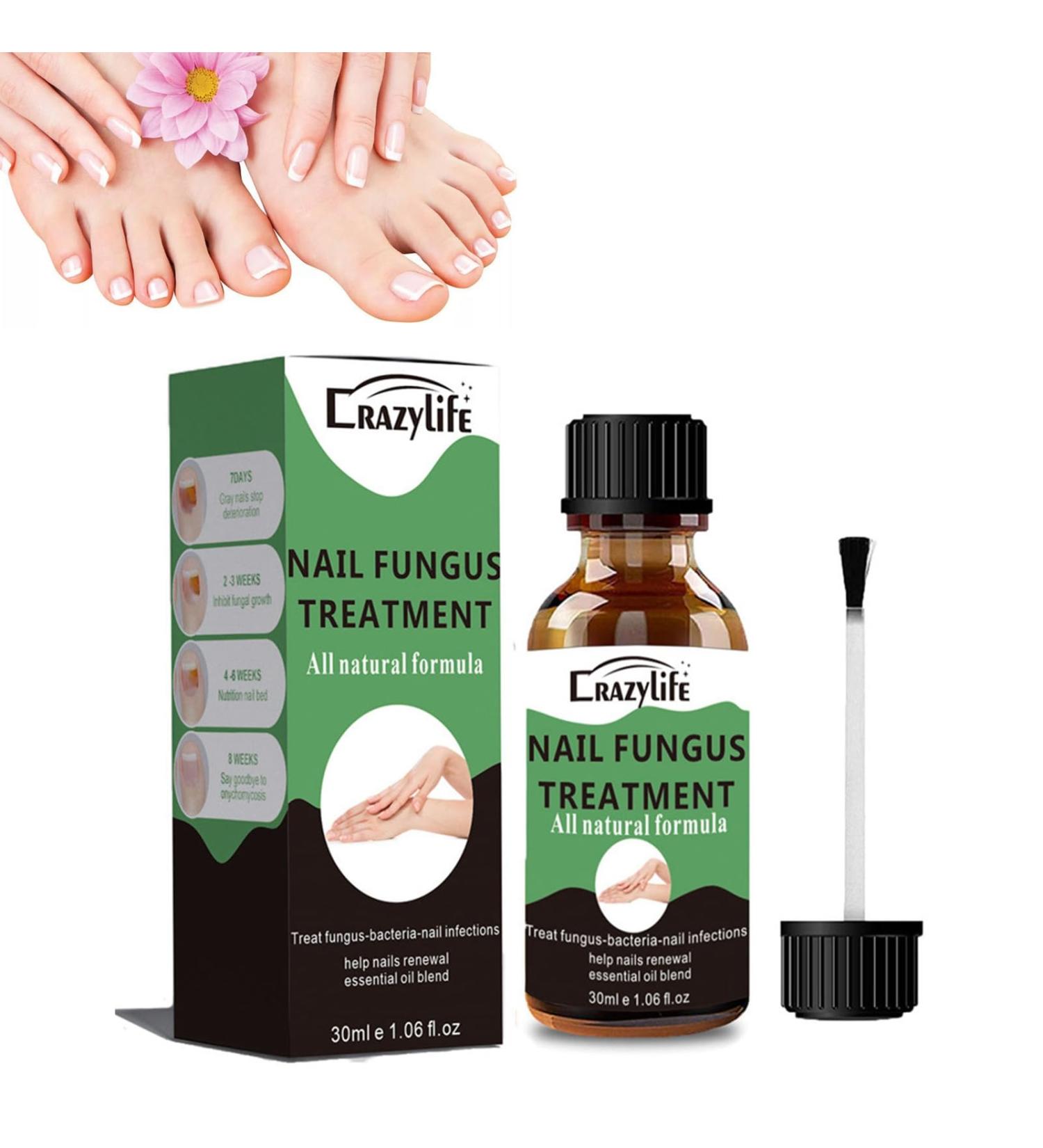 Nail Oil - Extra Strength Nail Care Serum for Healthy Fingernails & Toenails | 30ml Nail Growth Treatment for Discoloration & Beautiful Manicure - Buy Online on GoSupps.com
