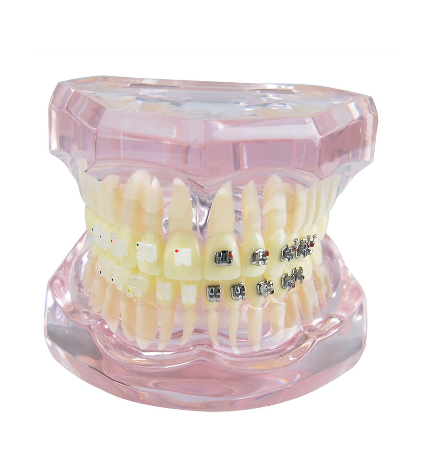 Buy Liusu Children's Tooth Theory Dental Model - Transparent Implant & Orthodontic Demo Model with Self-Ligating Clips | International Shipping Available - Buy Online on GoSupps.com