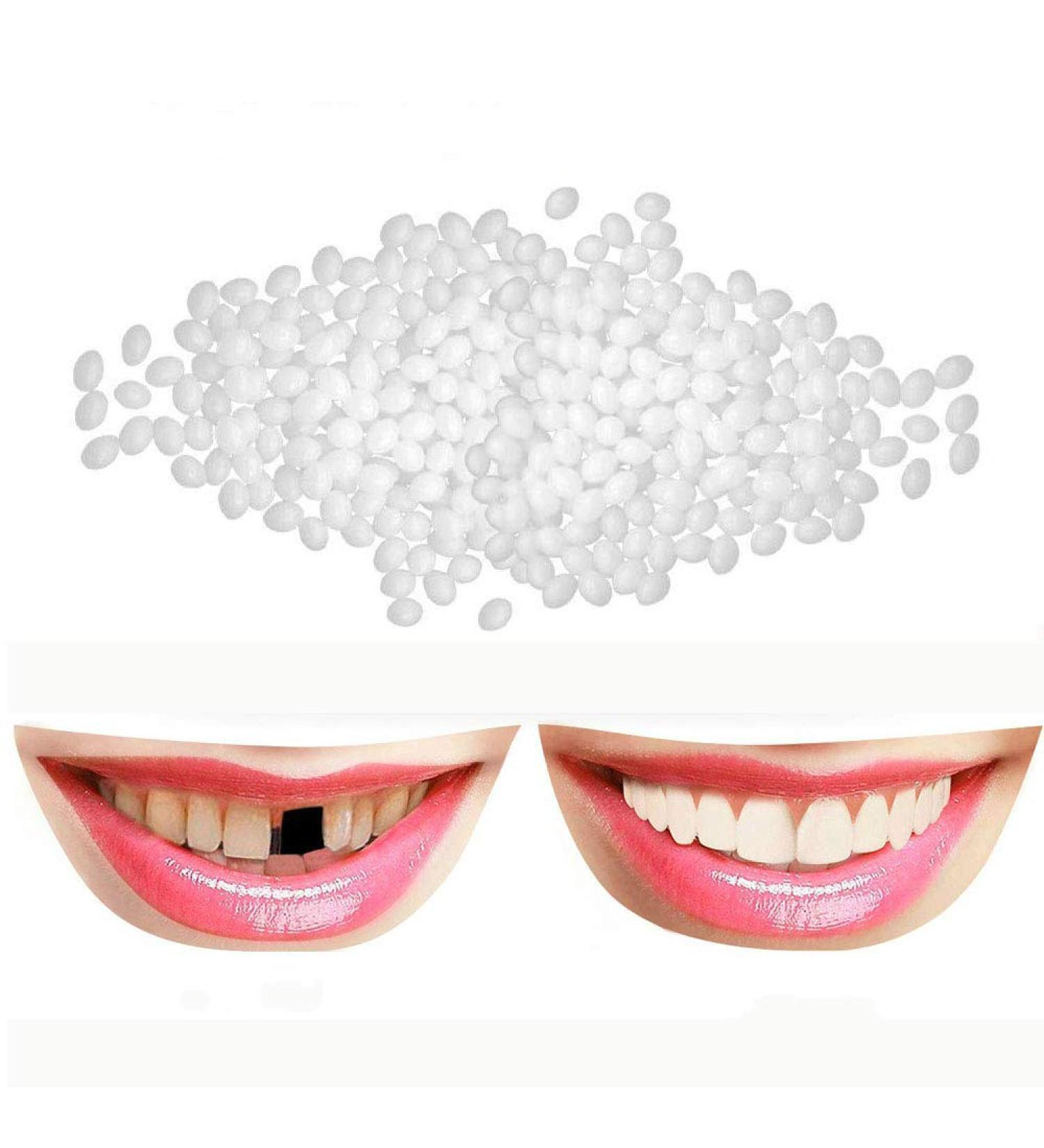 Tooth Repair Kit - Instant Temporary Teeth Replacement for Damaged & Missing Teeth | Best Dental Fix Solution - Buy Online on GoSupps.com