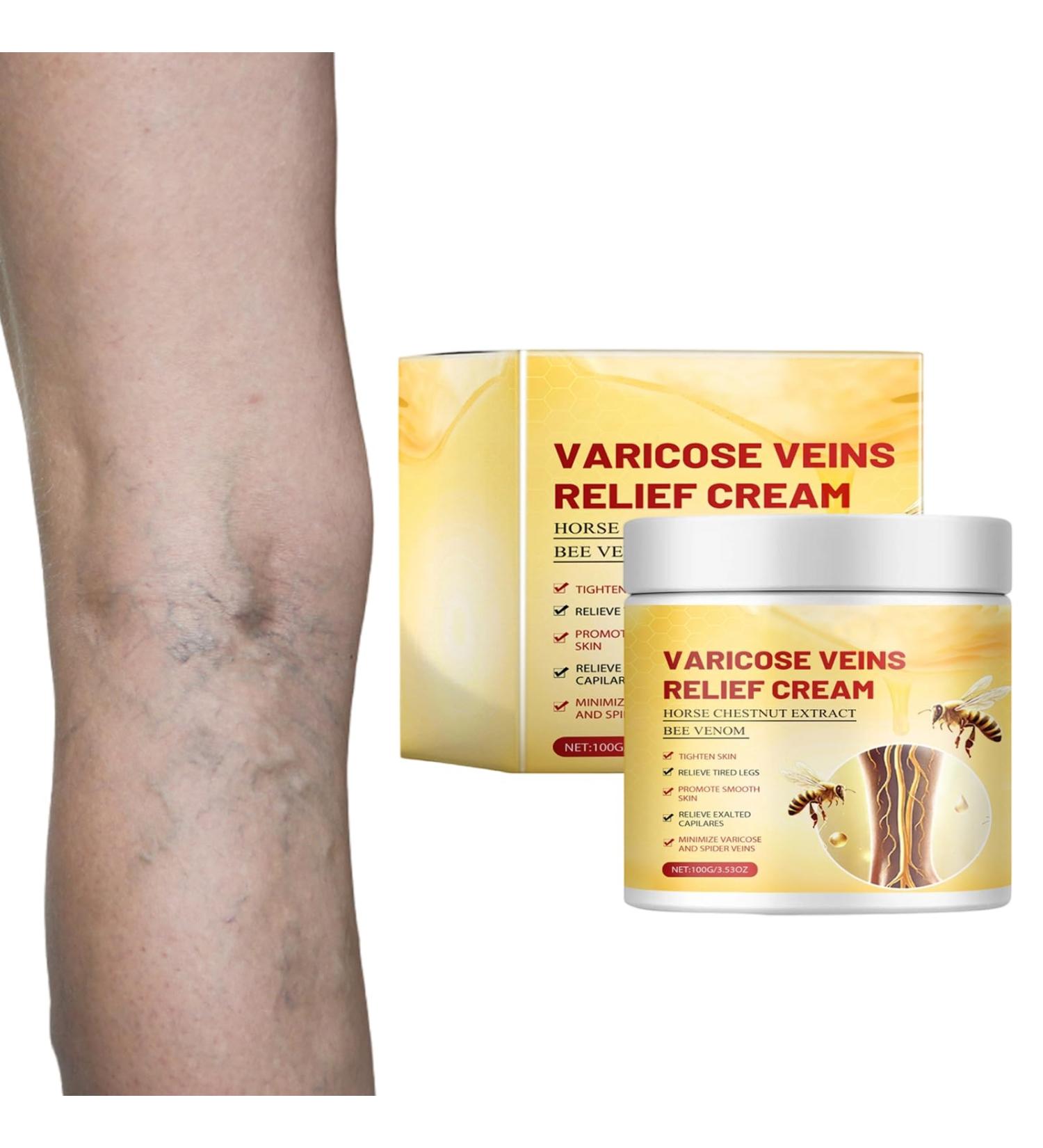 Cr me pour Varices au Venin d'Abeille Cr me de Traitement et R cup ration des Varices Unisexe - Buy Online on GoSupps.com