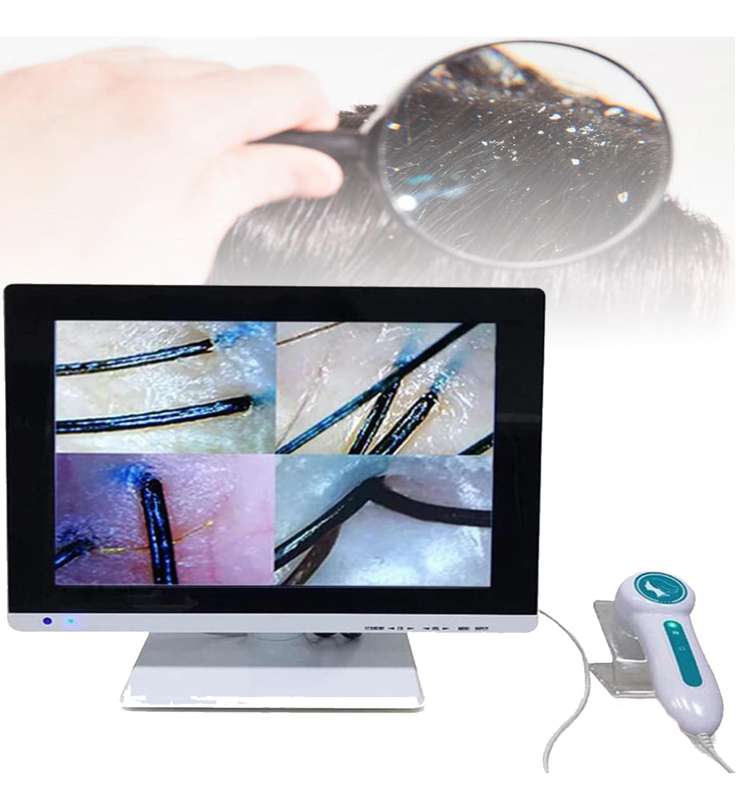 Scalp Detector Skin Diagnosis Hair Analyzer 15 Inch Screen Digital Skin Detector Moisture Tester Hair Skin Analyzer Machine for Home Beauty Salon Spa - Buy Online on GoSupps.com