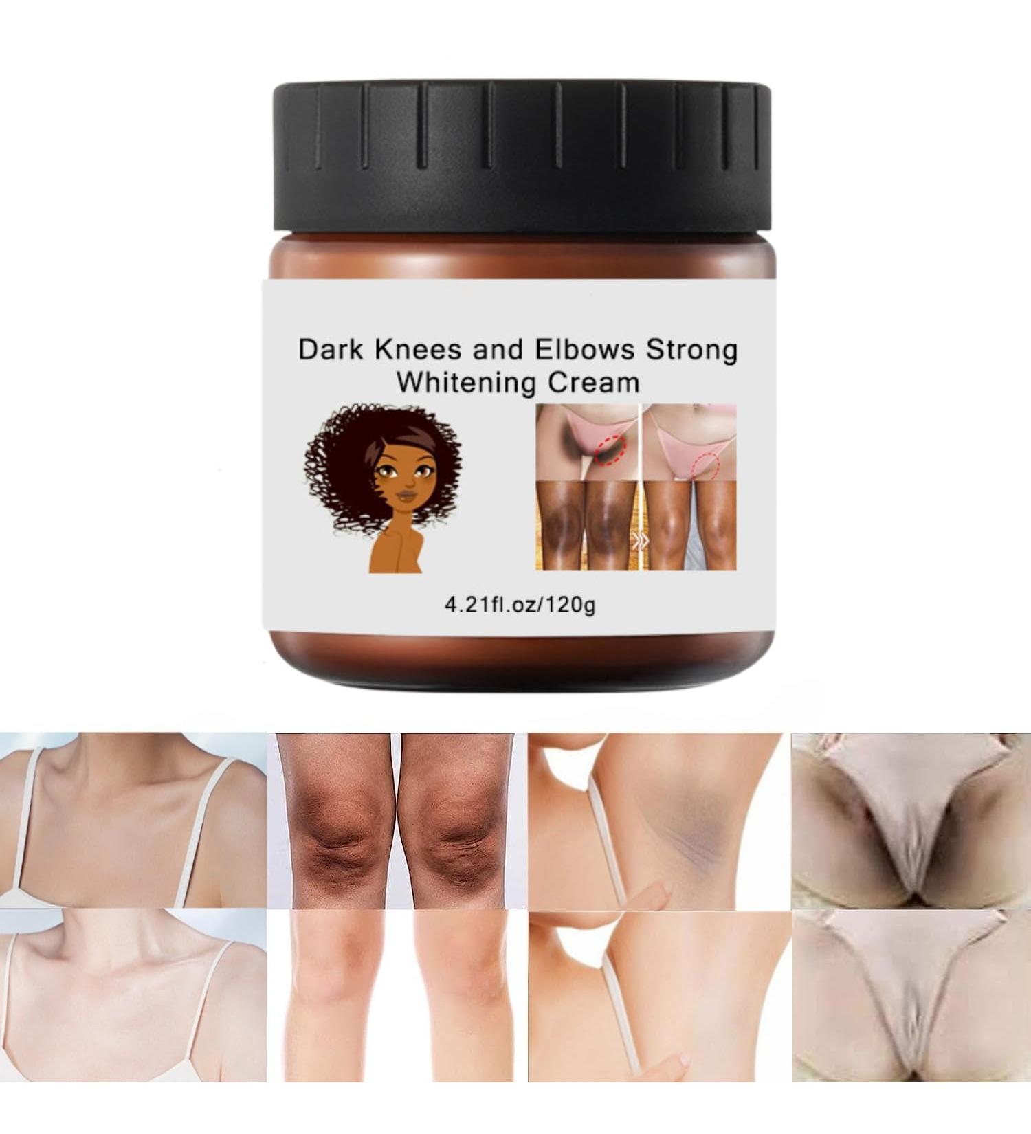 120g Cremas Para Las Manchas de La Corporales Para Piel Entrepierna Manchas Codos Piernas Zonas ntimas Cara Axilas Rodillas Cuello - Buy Online on GoSupps.com