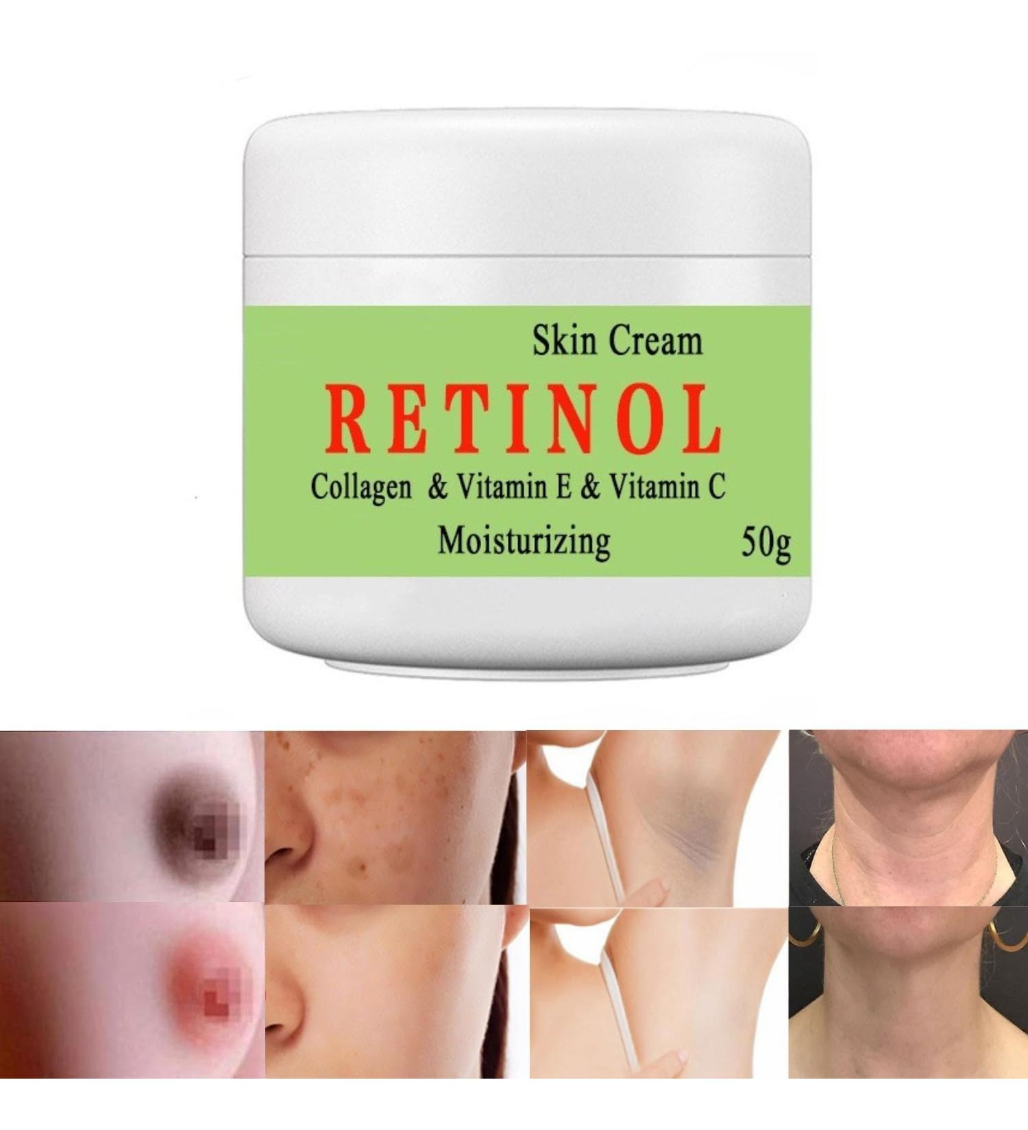 Cremas Para Las Manchas de La Cara 50g Cremas para quitar manchas de la cara Vitamin C&E Face Moisturizer Cream Crema para manchas oscuras en la piel (1pcs) 1 Fl Oz (Pack of 1) - Buy Online on GoSupps.com