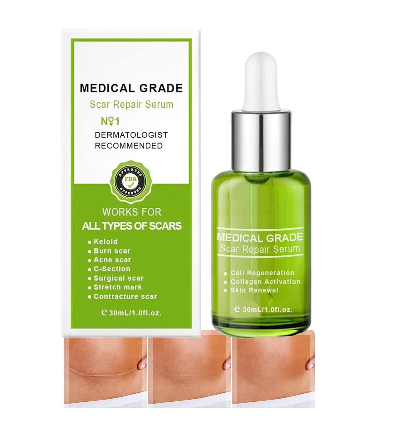 Goopgen Advanced Scar Repair Serum - Medical Grade Nature Scar Treatment for All Types of Scars | 1pcs - Buy Online on GoSupps.com