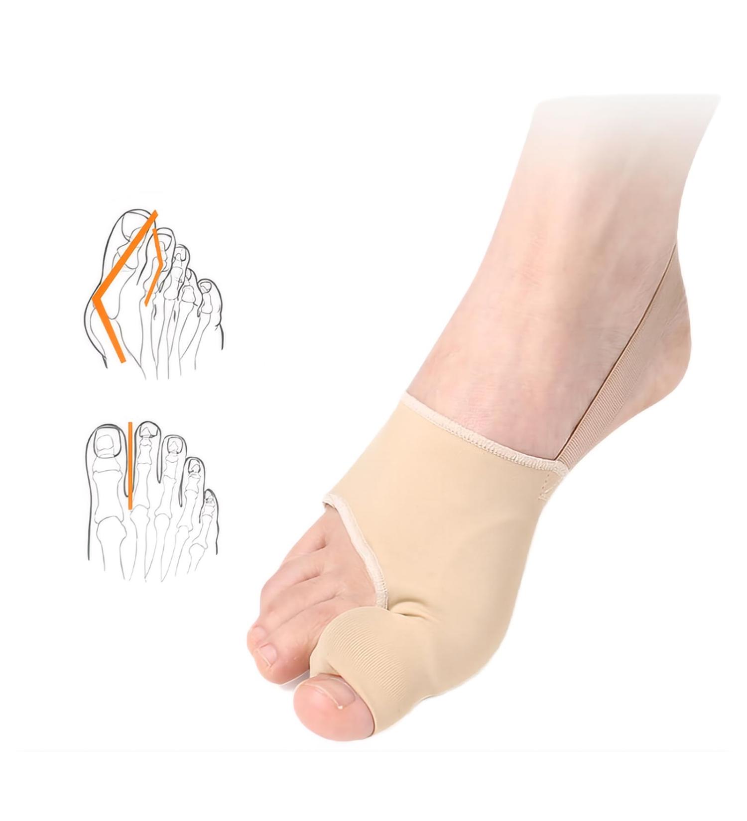 Bunion Corrector for Women & Men | Big Toe Straightener & Orthopedic Splint for Hallux Valgus | Comfortable & Breathable Day/Night Support - Buy Online on GoSupps.com