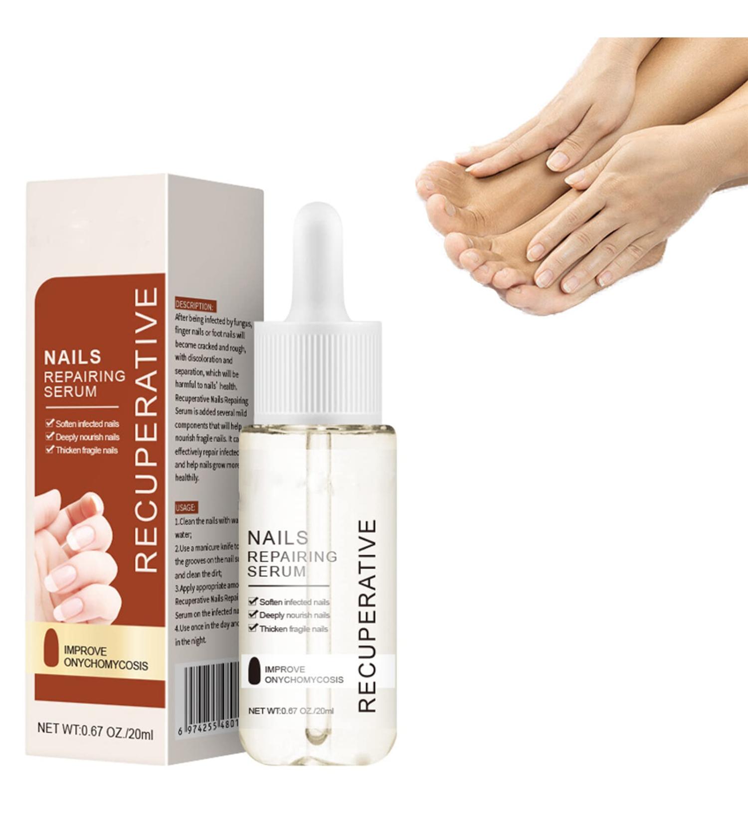 7 Days Nail Growth and Strengthening Serum 1/2/3/5 bottles Nail Strengthener and Growth Serum (1 bottle) - Buy Online on GoSupps.com