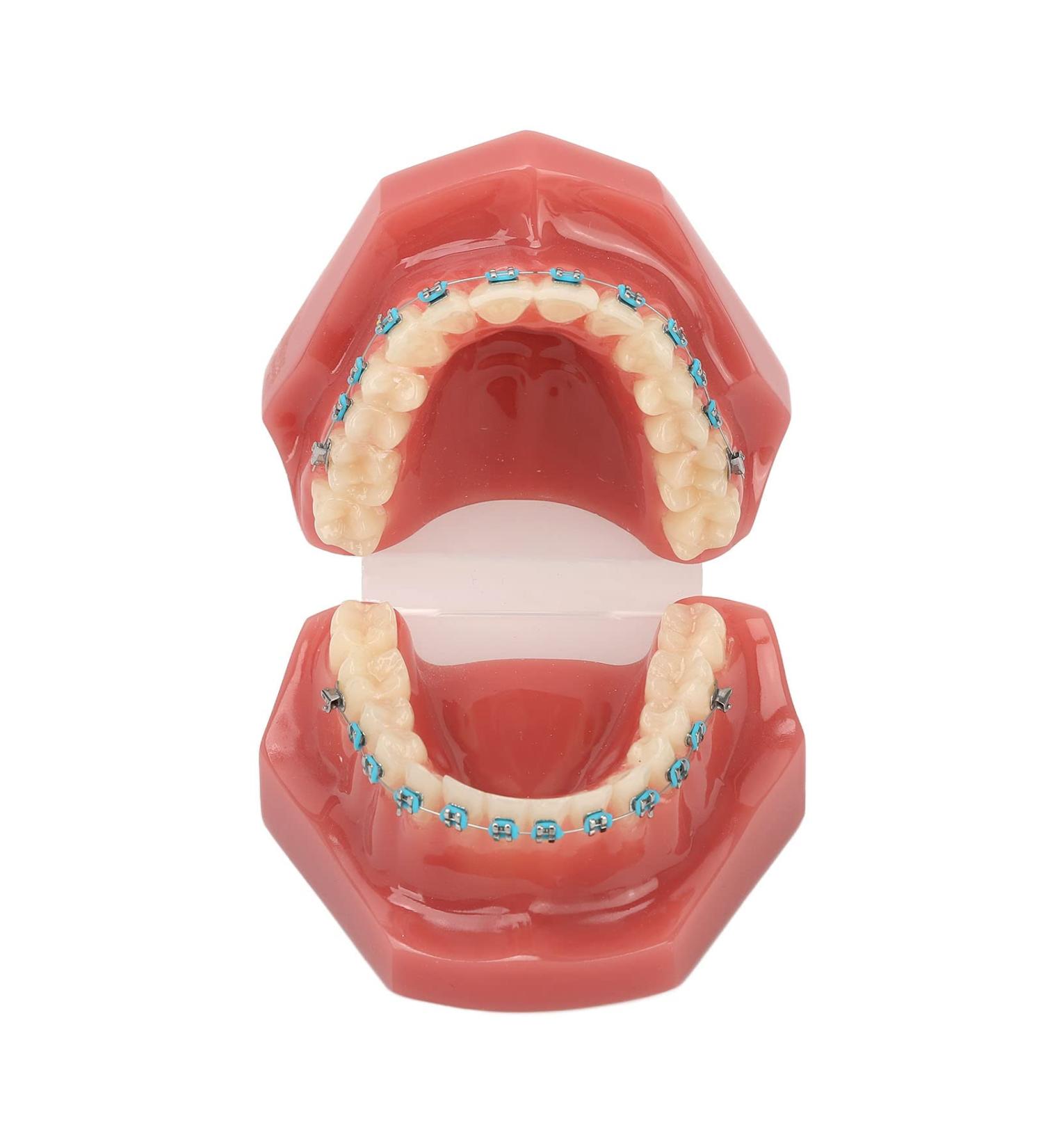 Orthodontic Model | 28 Partial Dental Resin Demonstration & Bracket Model for International Shipping - Buy Online on GoSupps.com