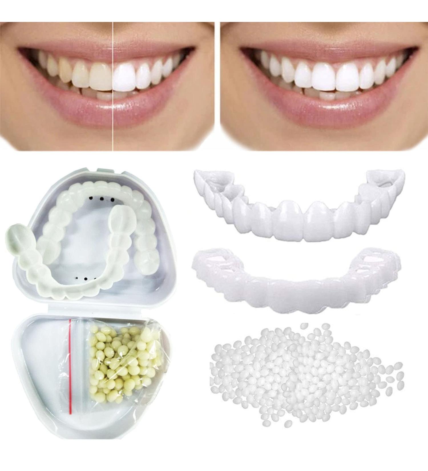 Shop Tistics Veneer Prostheses - Cosmetic Fake Teeth for Men & Women | Smile Bright with 2 Pairs of Provisional Dentures & Tooth Whitening - Buy Online on GoSupps.com
