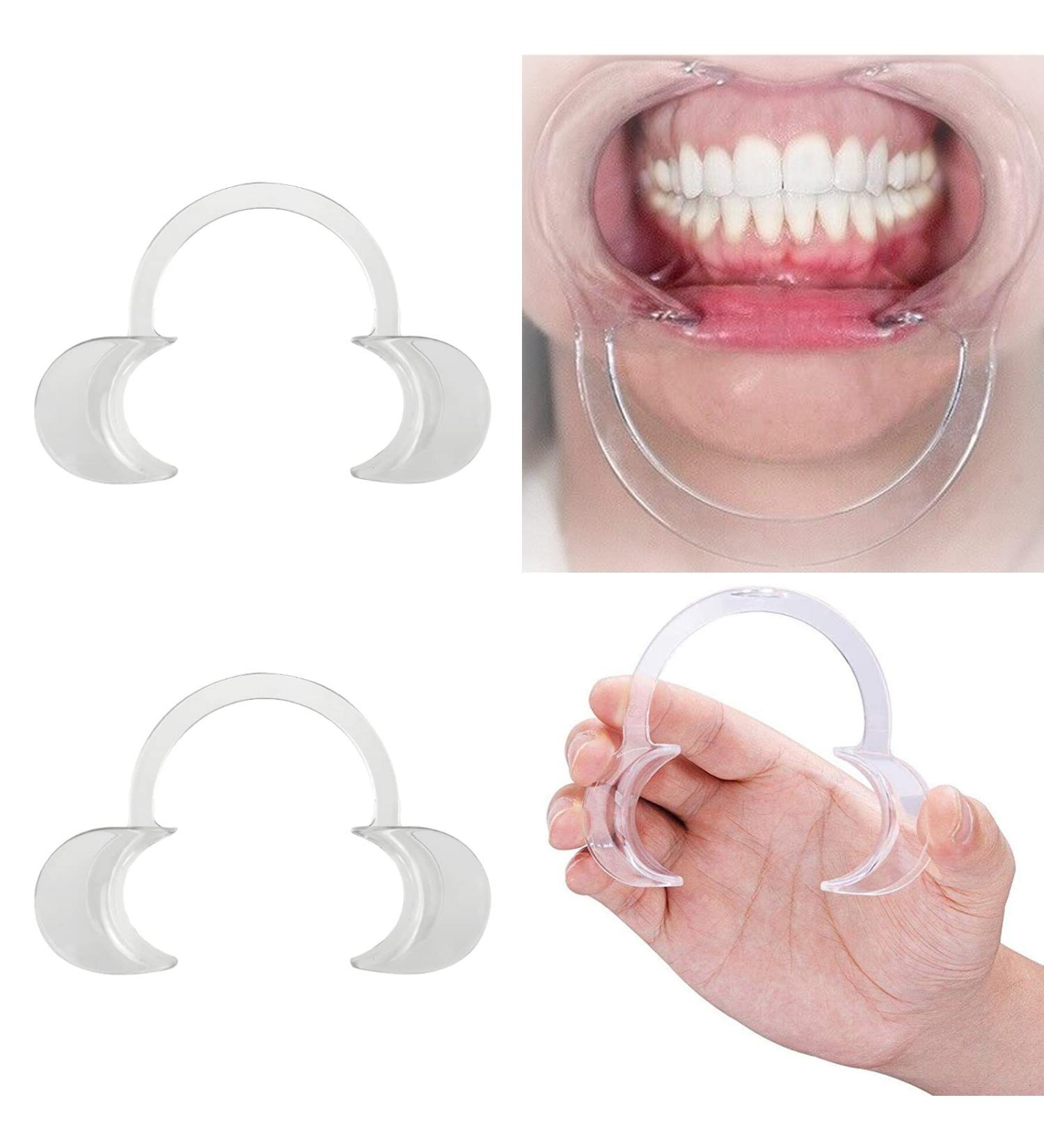 Dental Mouth Opener Set - 2PCS Cheek Retractors for Teeth Whitening Game | Suitable for Adults & Kids - Buy Online on GoSupps.com
