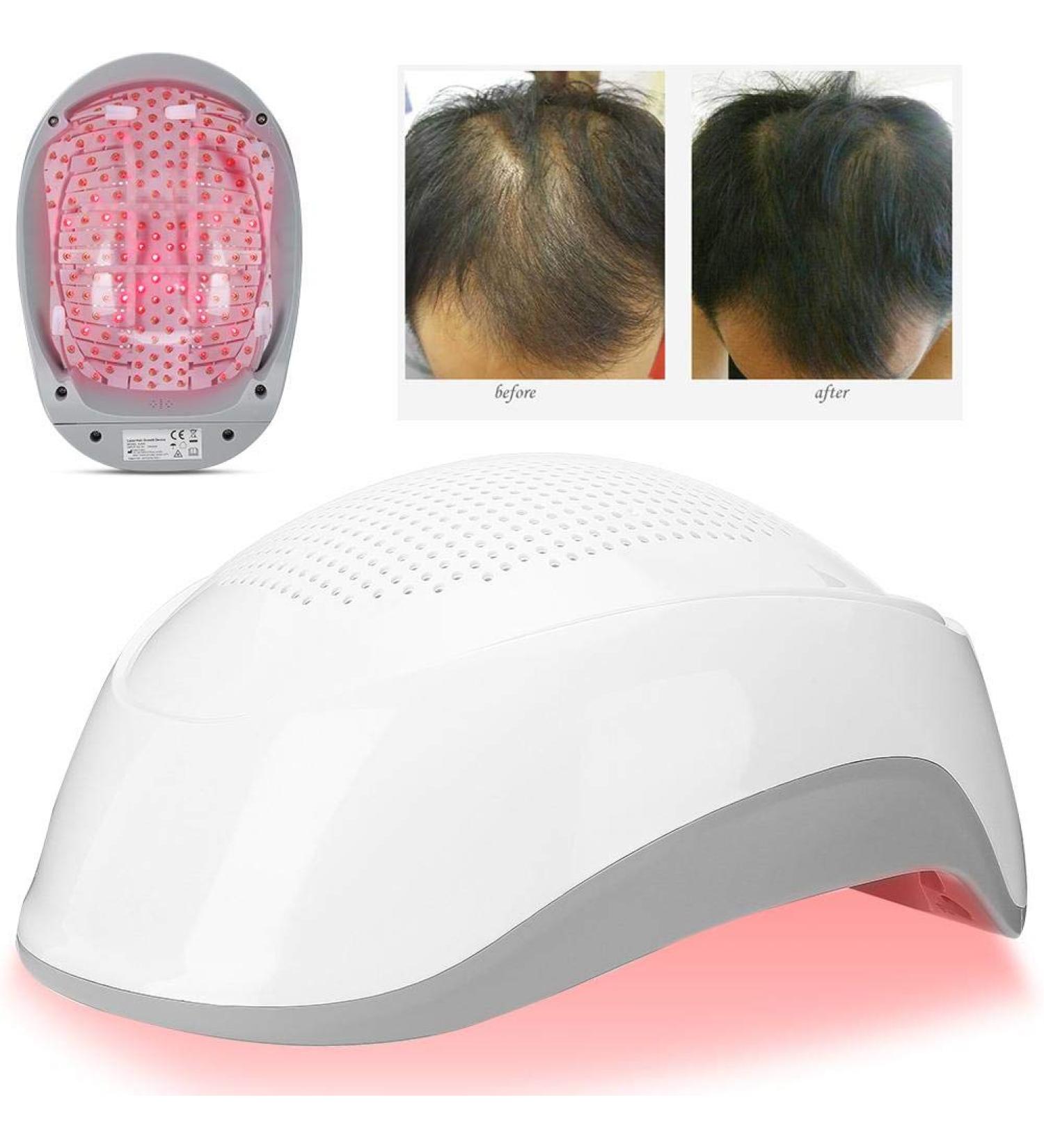 Laser Hair Growth Device - 180 Light Chips for Enhanced Hair Growth (Gray) | International Shipping Available - Buy Online on GoSupps.com