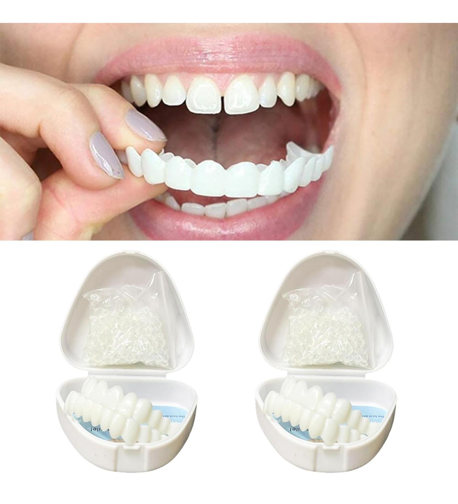 Dazzluxe Brightening Snap-In Prostheses | Upper & Lower Jaw Artificial Teeth | Immediate White Veneers for a Confident Smile - Buy Online on GoSupps.com