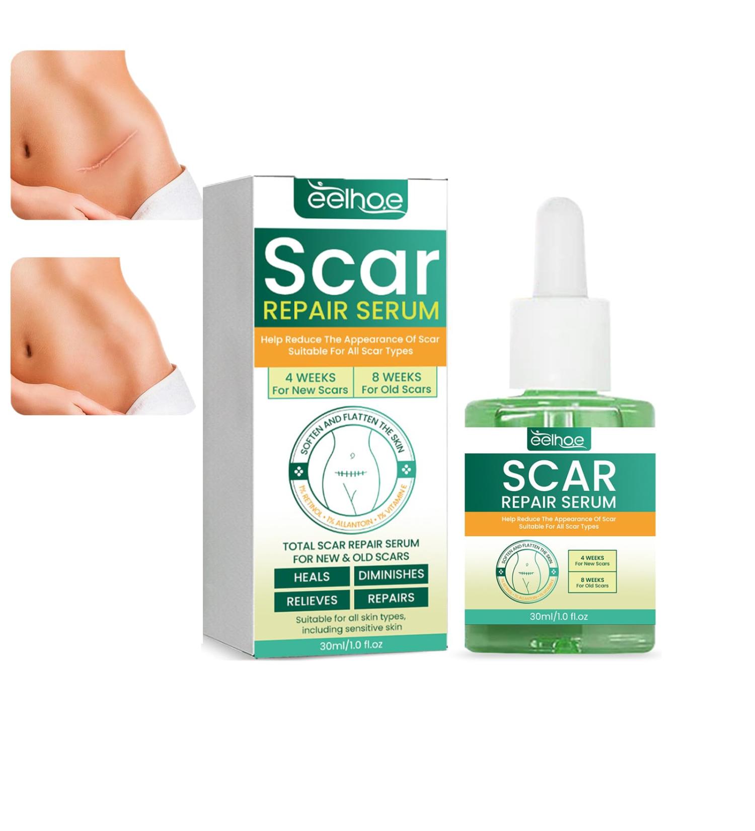 ScarRevita Advanced Repair Serum - Scar Removal Spray for All Skin Types (1PC) - Buy Online on GoSupps.com