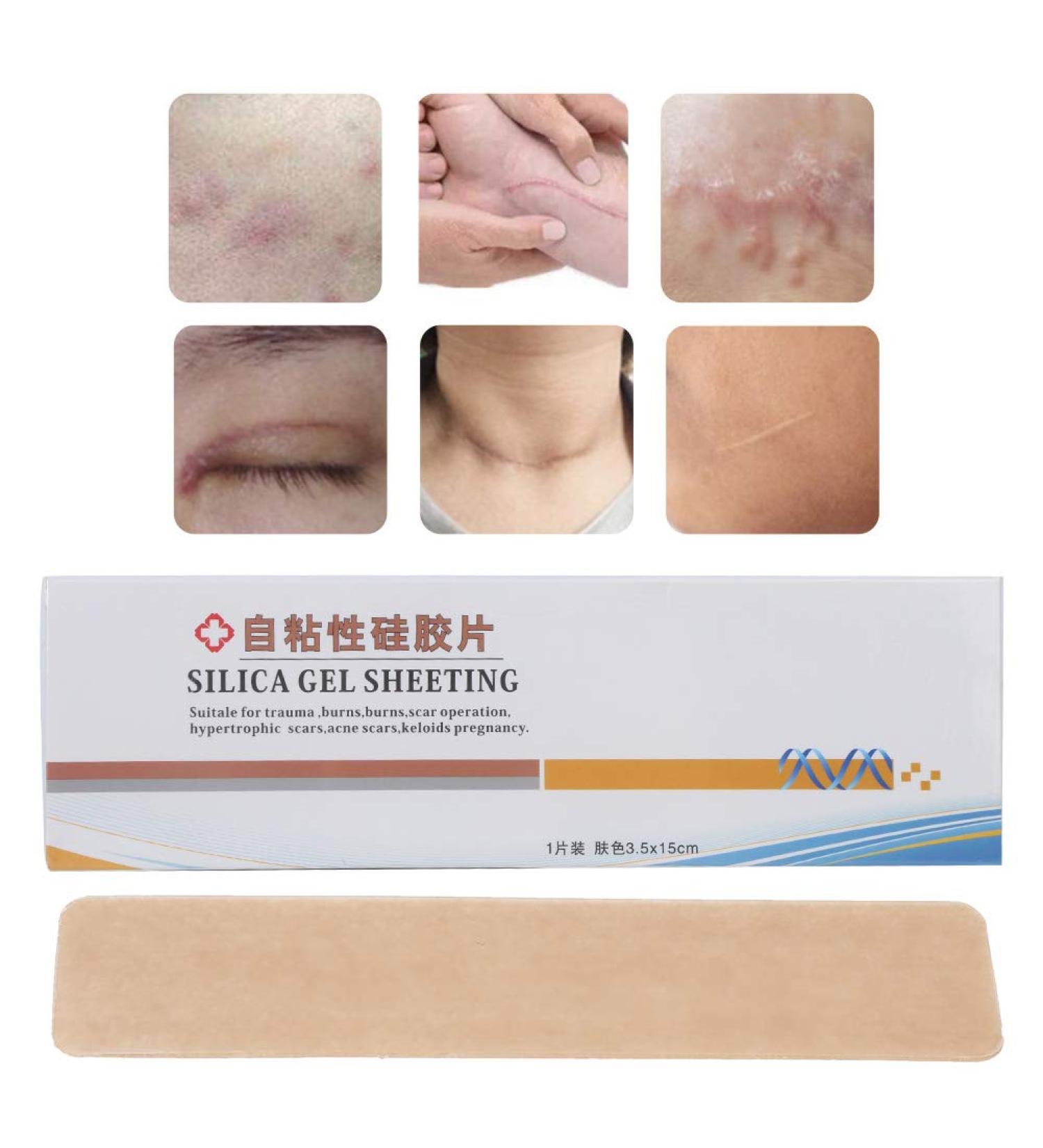 Silicone Scar Sheet - Self Adhesive, Portable & Durable for Wound Marks Removal - Ultra-Thin Concealer Surgery Burn Scar Sticker for All Skin Types - Buy Online on GoSupps.com