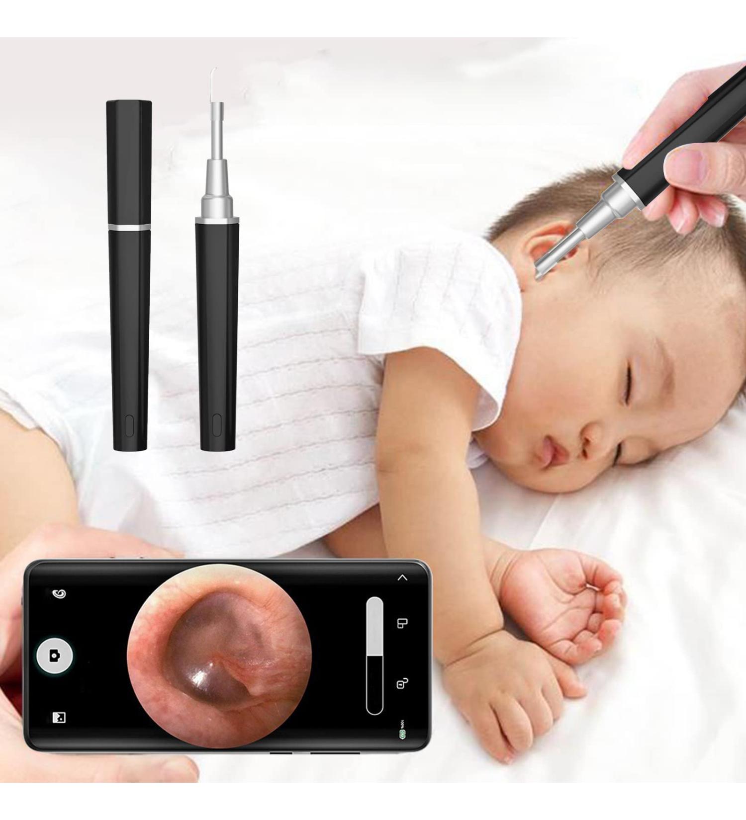 1080p HD Digital Otoscope Camera with Light - Ear Wax Removal WiFi Endoscope for iPhone iPad & Android - IP67 Waterproof 3.9mm Ultra-Thin Design (Black) - Buy Online on GoSupps.com