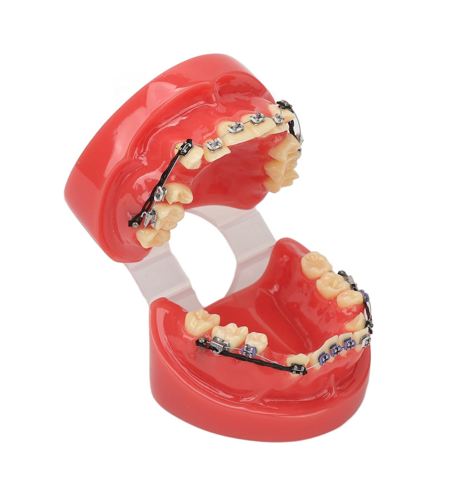 Orthodontic Demonstration Model | Professional Dental Model with Metal Wires & Brackets for Learning | International Shipping Available - Buy Online on GoSupps.com