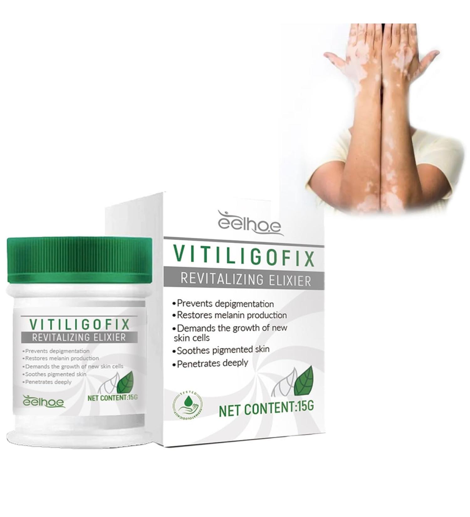 Vitiligo Treatment Cream | Natural White Spot Remover | Leukoplakia Relief | 2PCS - Buy Online on GoSupps.com