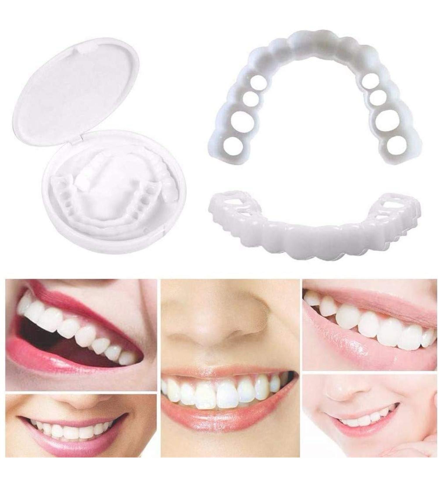 Xiaocui Teeth Prosthesis | Instant Perfect Smile Veneers | Comfort Fit Snap-On Cosmetic Dentistry - 2 Parts/Set - Buy Online on GoSupps.com