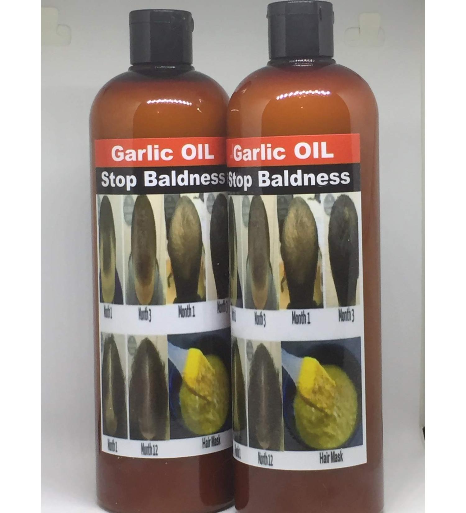 Garlic Hair Loss Treatment Mask - 500 ml | Incredible Benefits for Healthy Hair - Buy Online on GoSupps.com